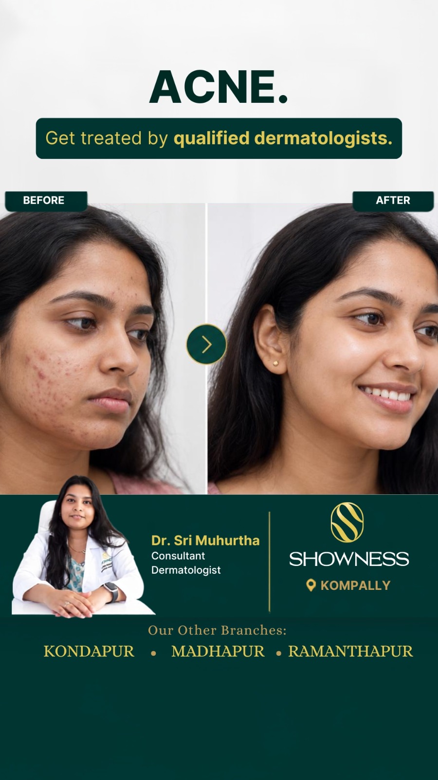 Showness Facebook ad