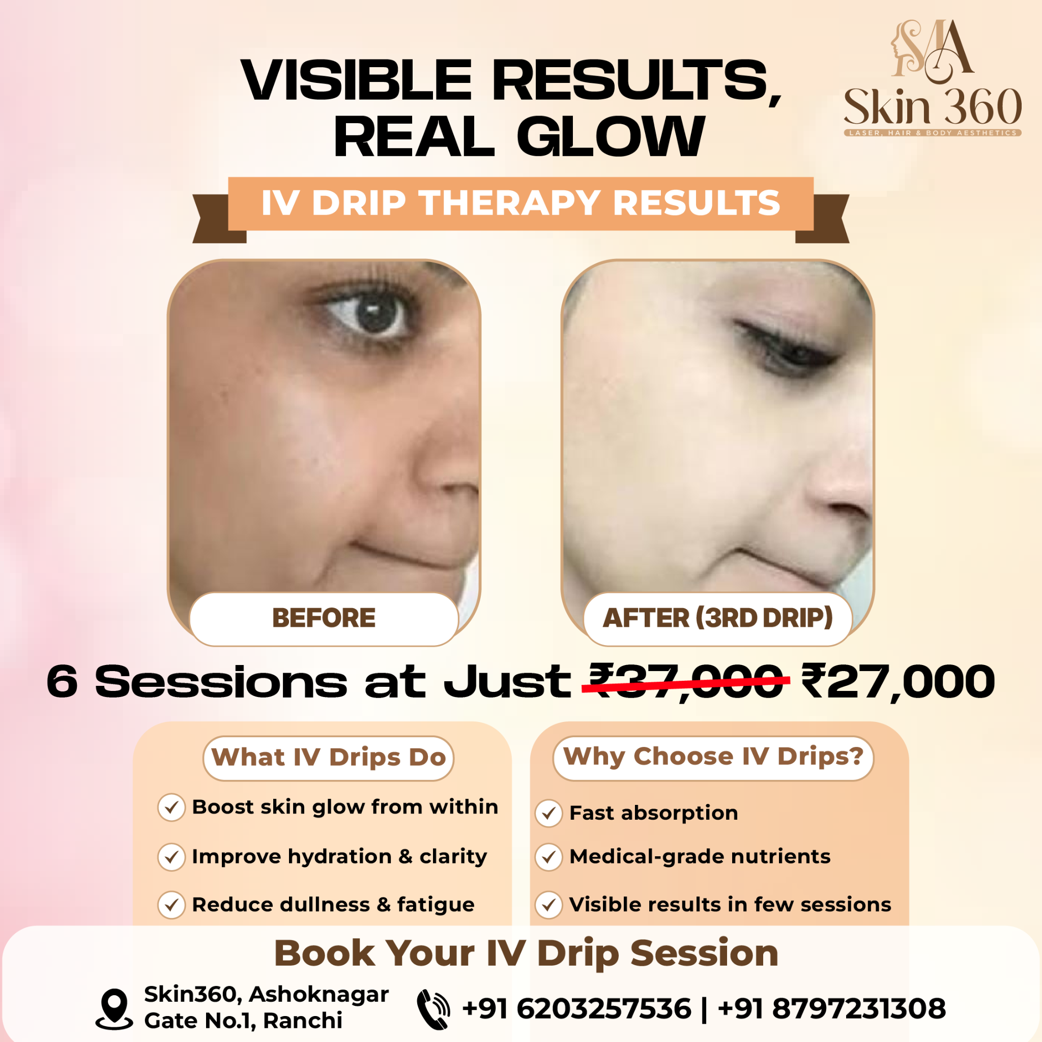 SKIN 360 Facebook ad: Chat on WhatsApp now to book your consultation