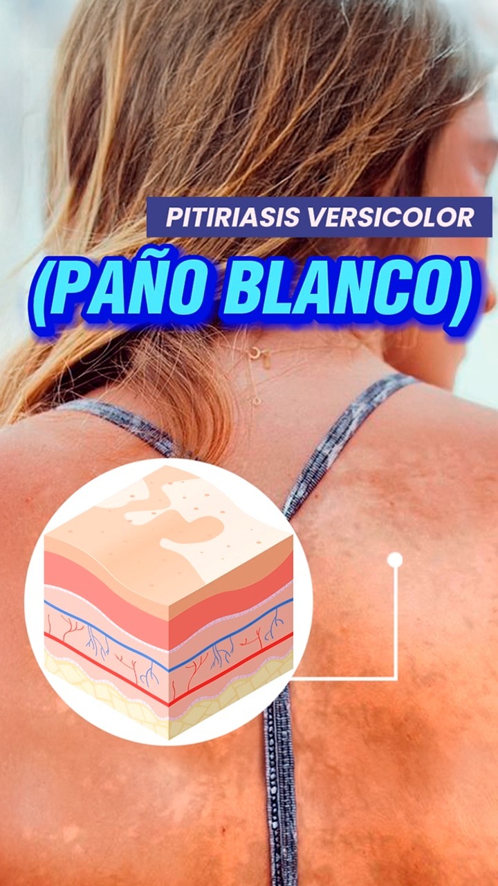 BioExport Panamá Facebook ad: ¿Sabías que el paño blanco es causado por…