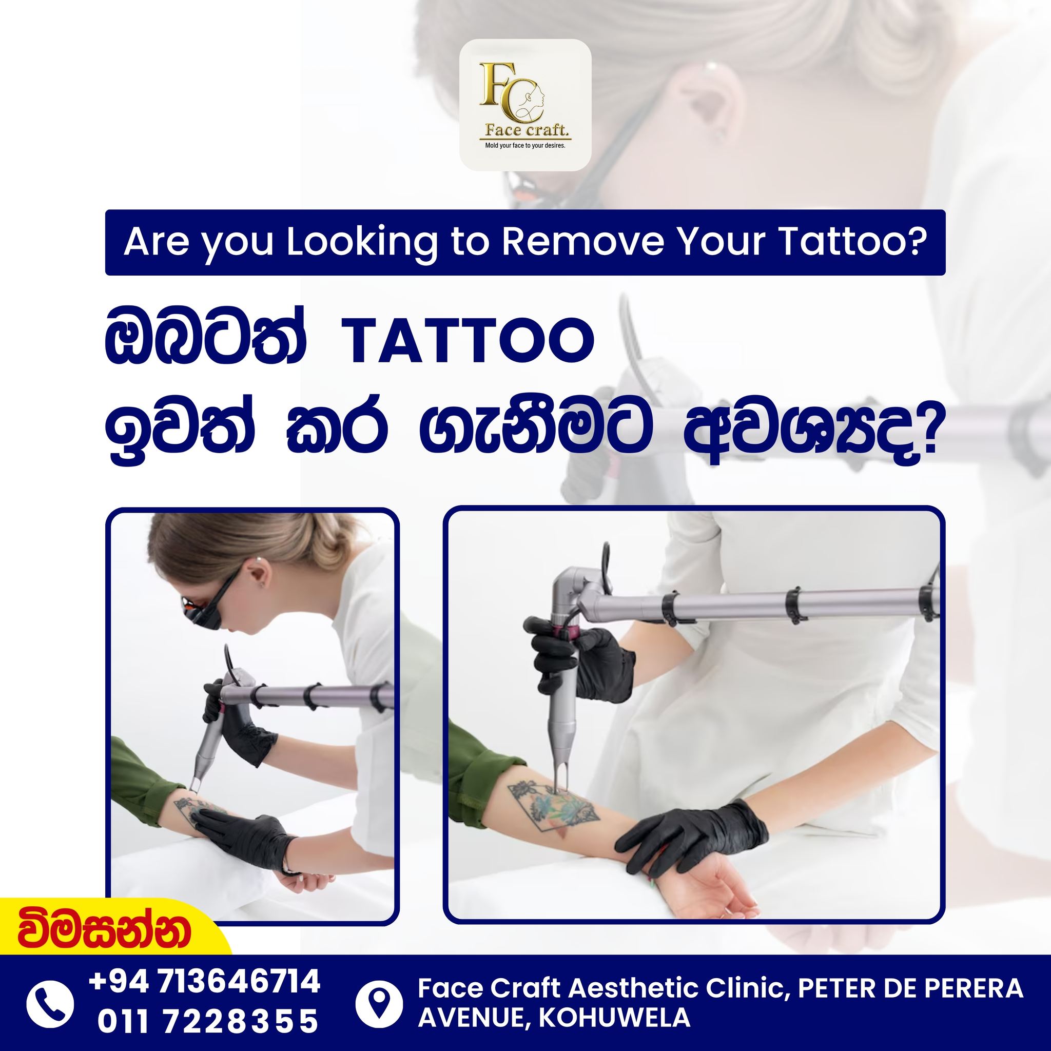 Face Craft Aesthetic Clinic Facebook ad: ඔබගේ TATTOO එකත් ඉවත් කර ගැනීමට අවශ්යද?