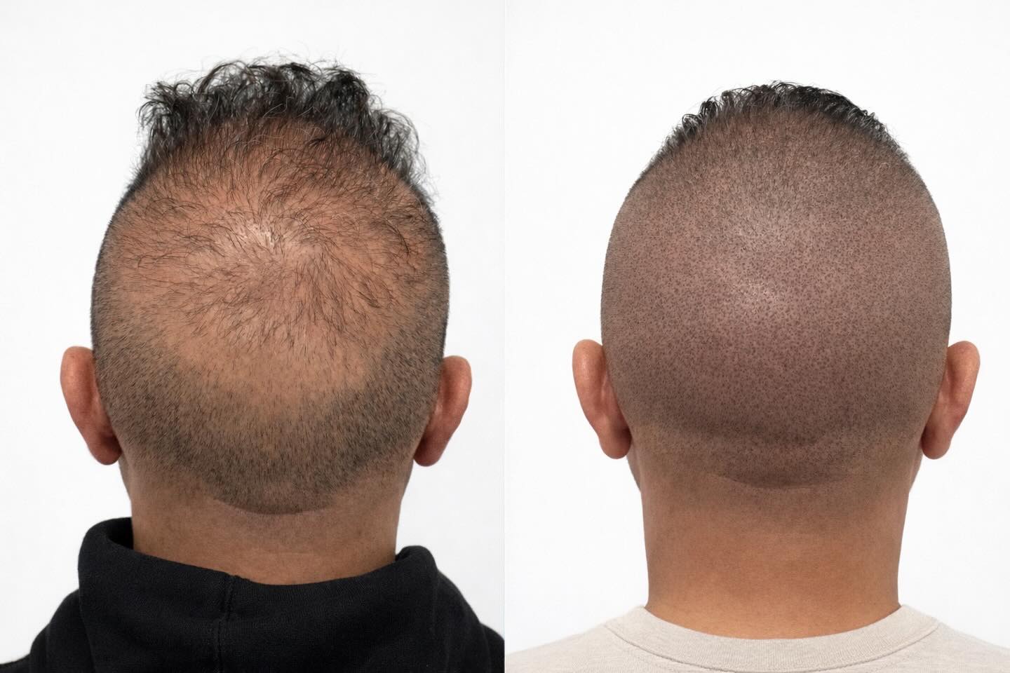 Scalp-Hair Clinic Facebook ad