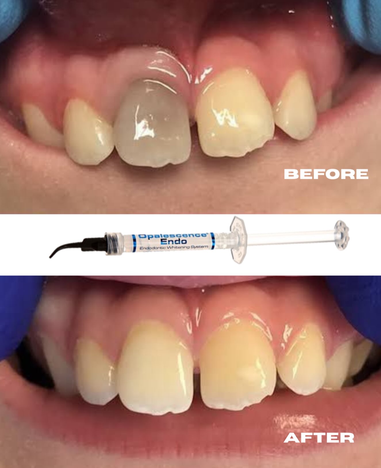 ELWAN Dental Supplies Facebook ad: WHAT A TRANSFORMATION!
