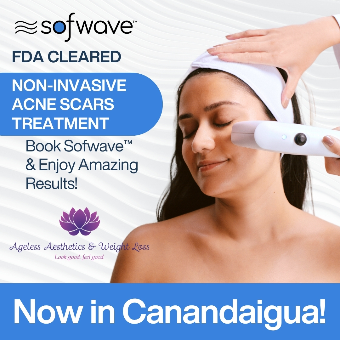 Sofwave Facebook ad