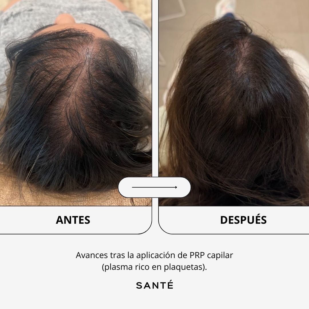 SANTÉ Clínica Estética Facebook ad