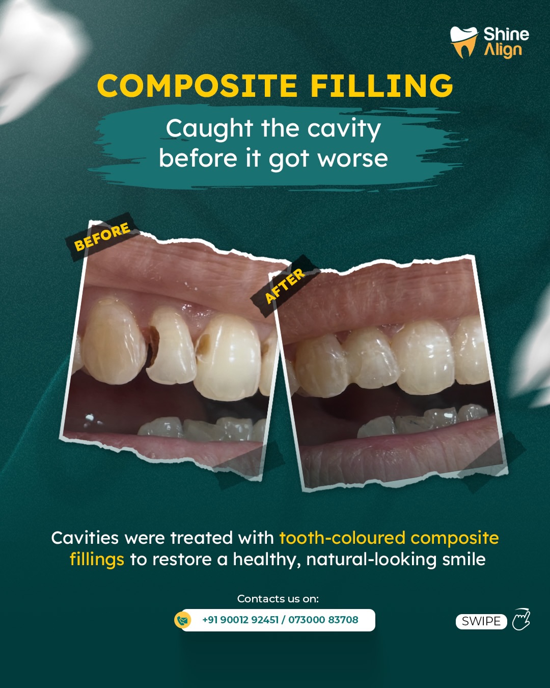 Shine Align Dental Care Facebook ad