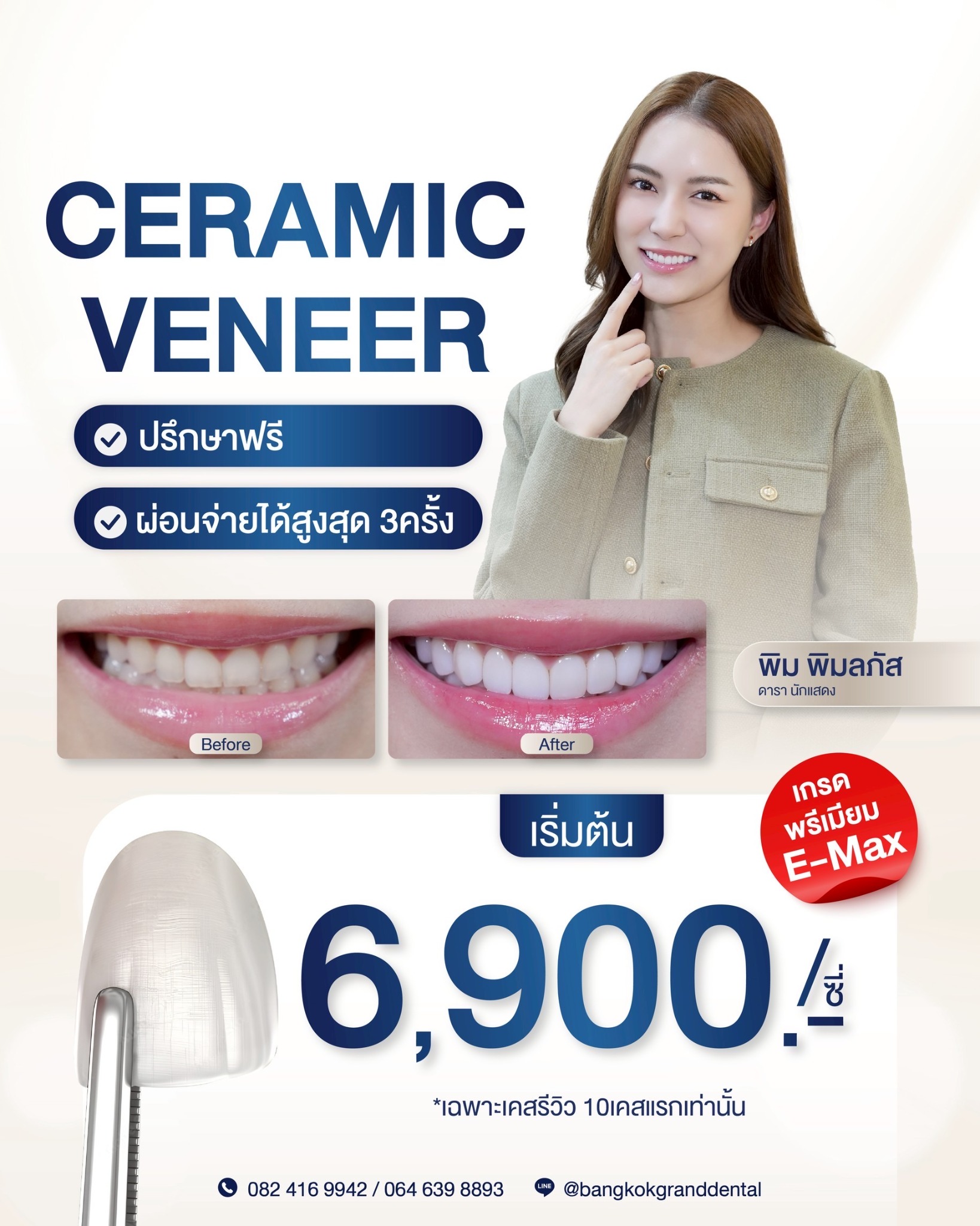 Bangkok Grand Dental Clinic ทำฟัน จัดฟัน รากเทียม Facebook ad: โปรเคสรีวิว วีเนียร์ (10 เคสแรกเท่านั้น!) ปรึกษาฟรี!