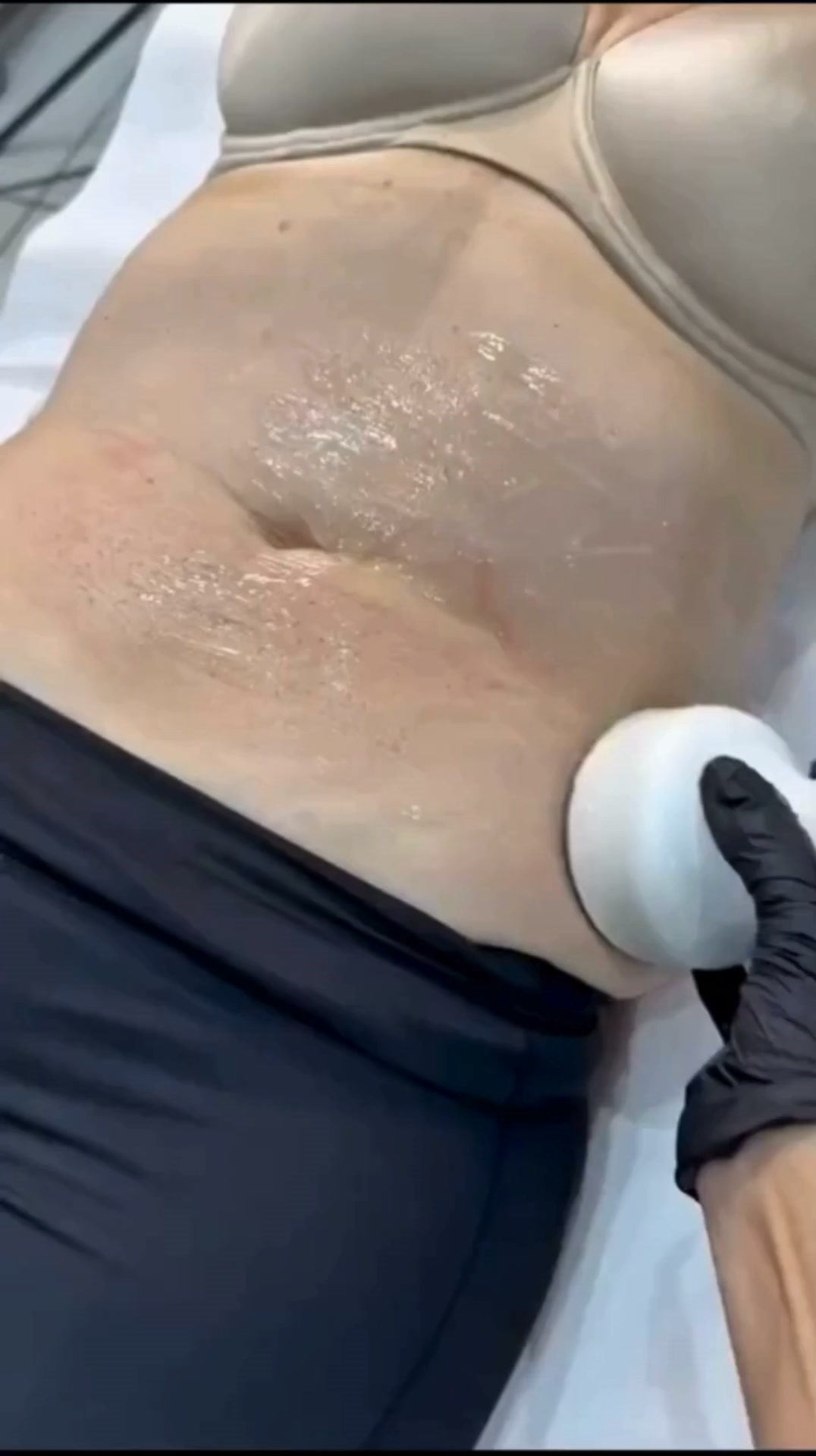 ContourCraft Facebook ad: Non-Surgical Tummy Tuck Now Available For Crawley &…
