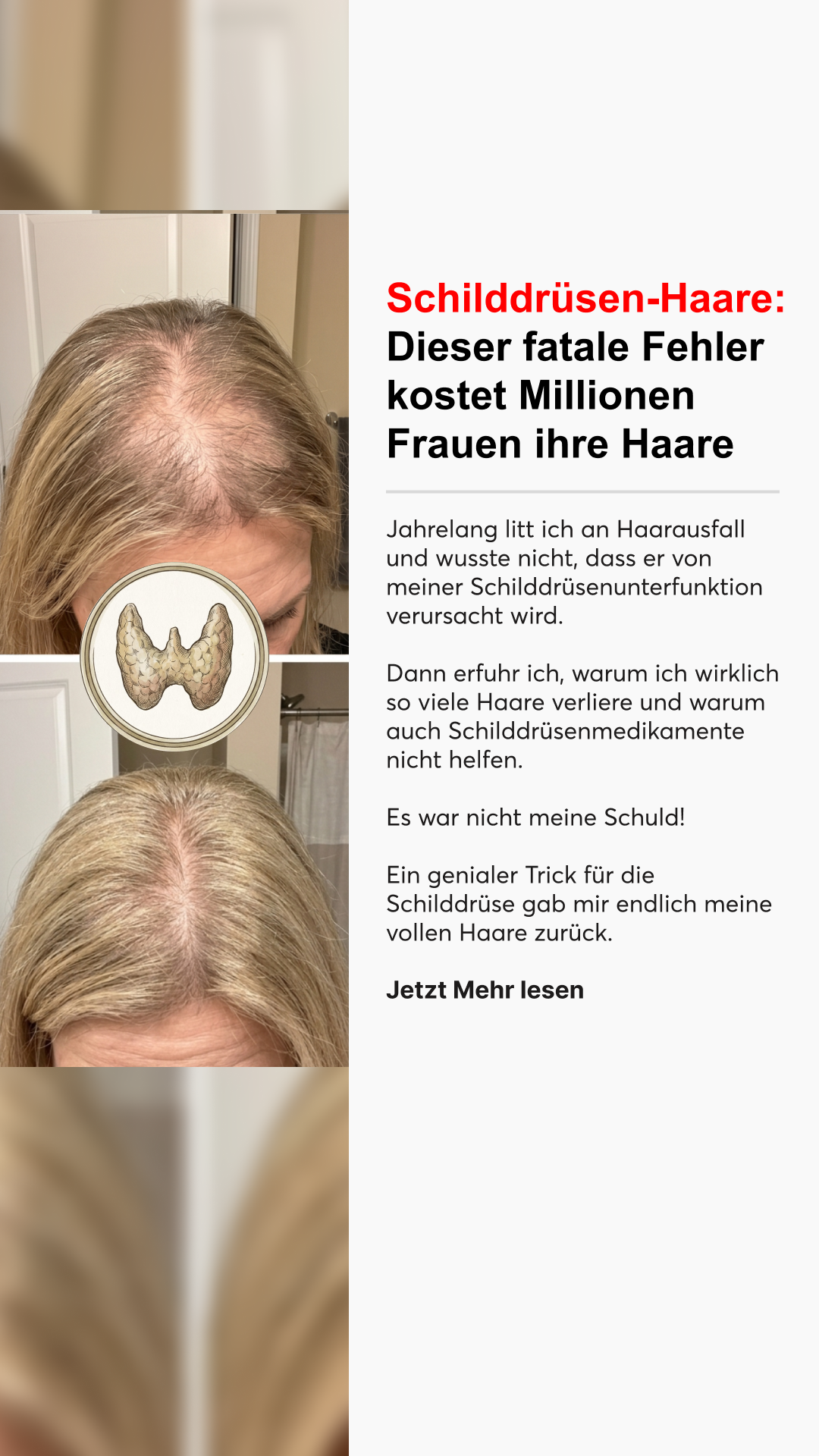 Mission Schilddrüse Facebook ad
