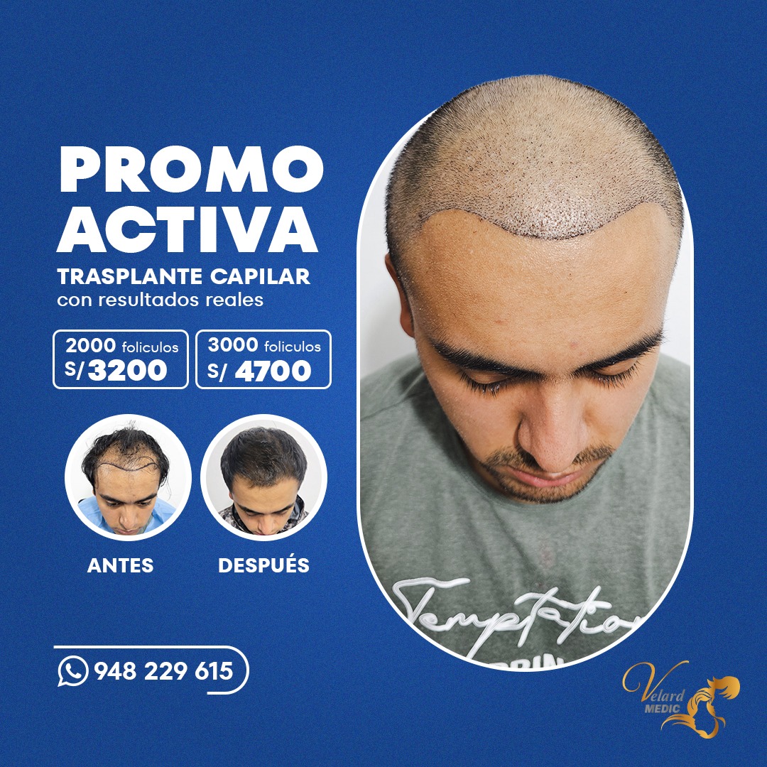 Velard Medic Capilar Facebook ad