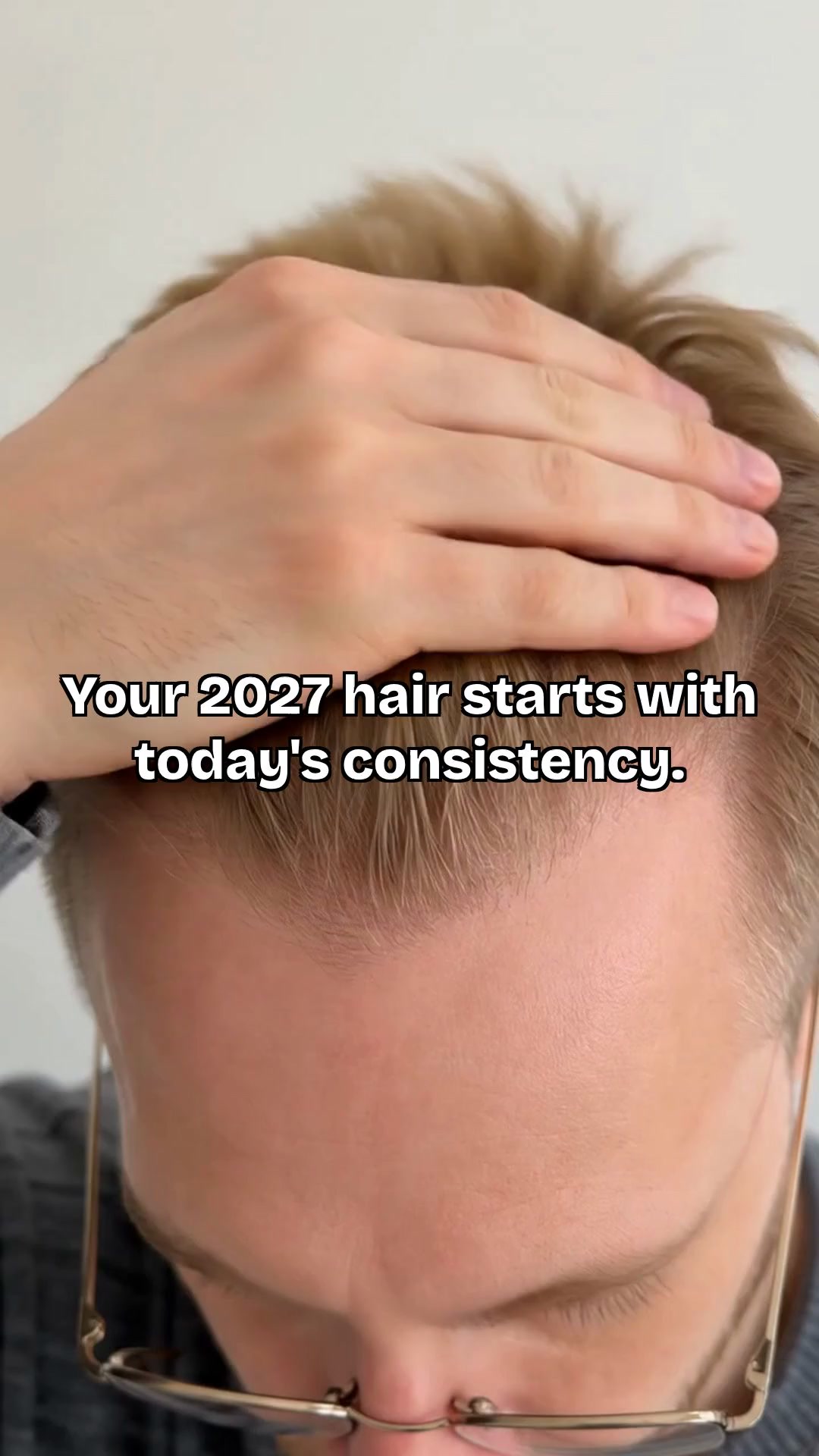 Scandinavian Biolabs Facebook ad: Next Year's Hairline Is Decided Now