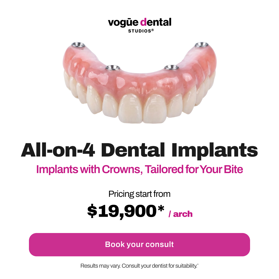 Vogue Dental Studios Facebook ad