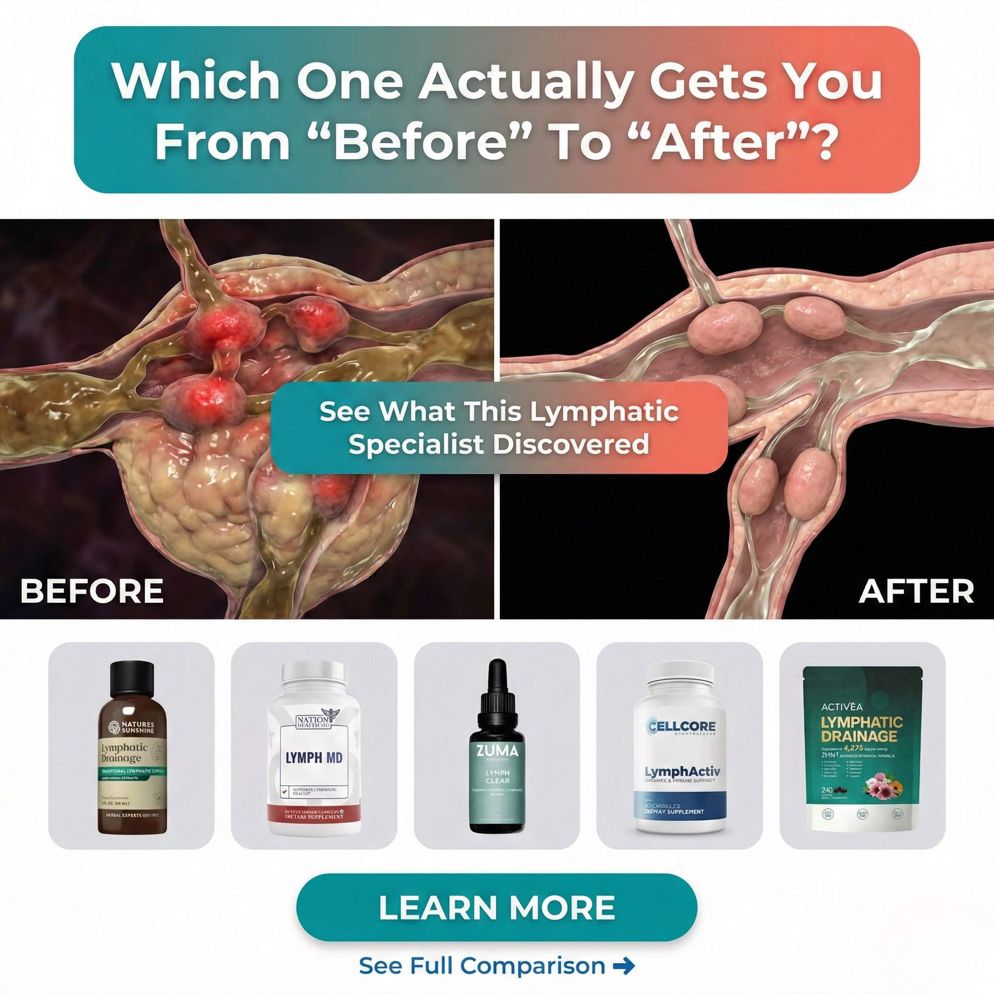 The Health Insider Facebook ad: Naturopath Ranks The Top 5 Lymphatic Drainage Supplements…