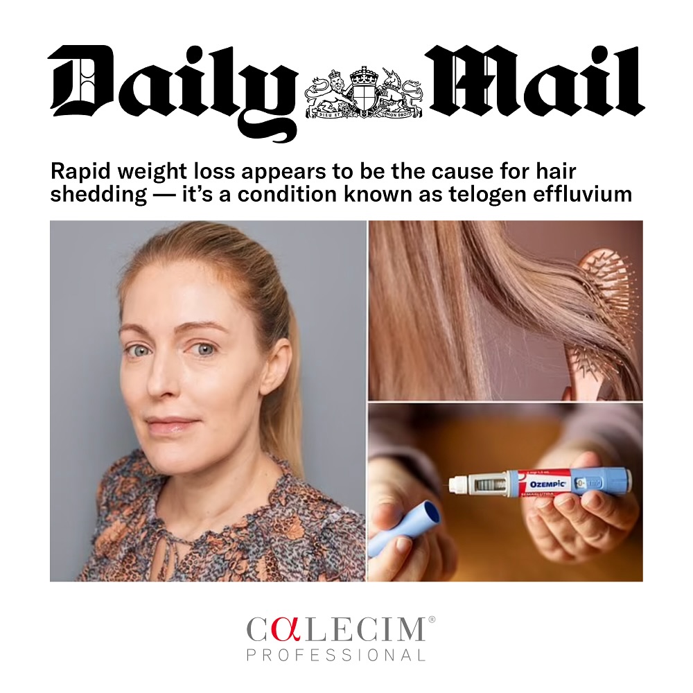 Calecim Professional Facebook ad