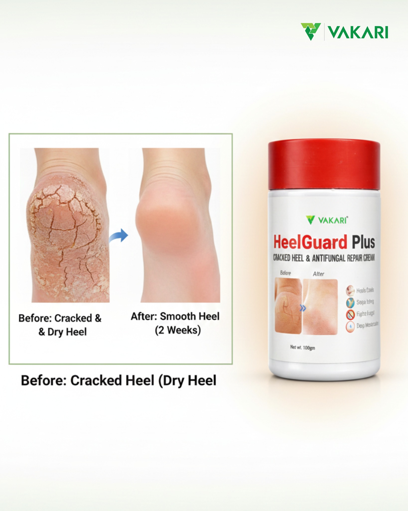 Vakari Personal Care Facebook ad: पैताला चिरा परेको, सुख्खा खुट्टा र चिलाउने समस्याले…