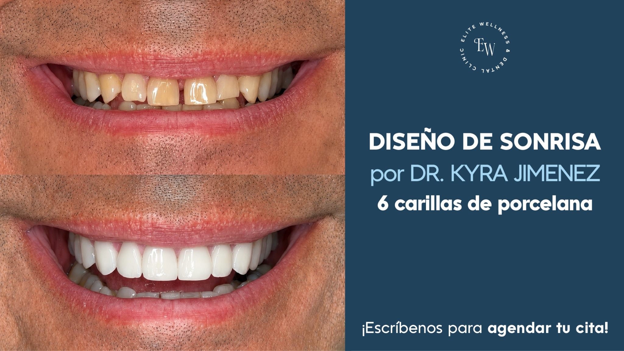 Elite Wellness and Dental Clinic Facebook ad