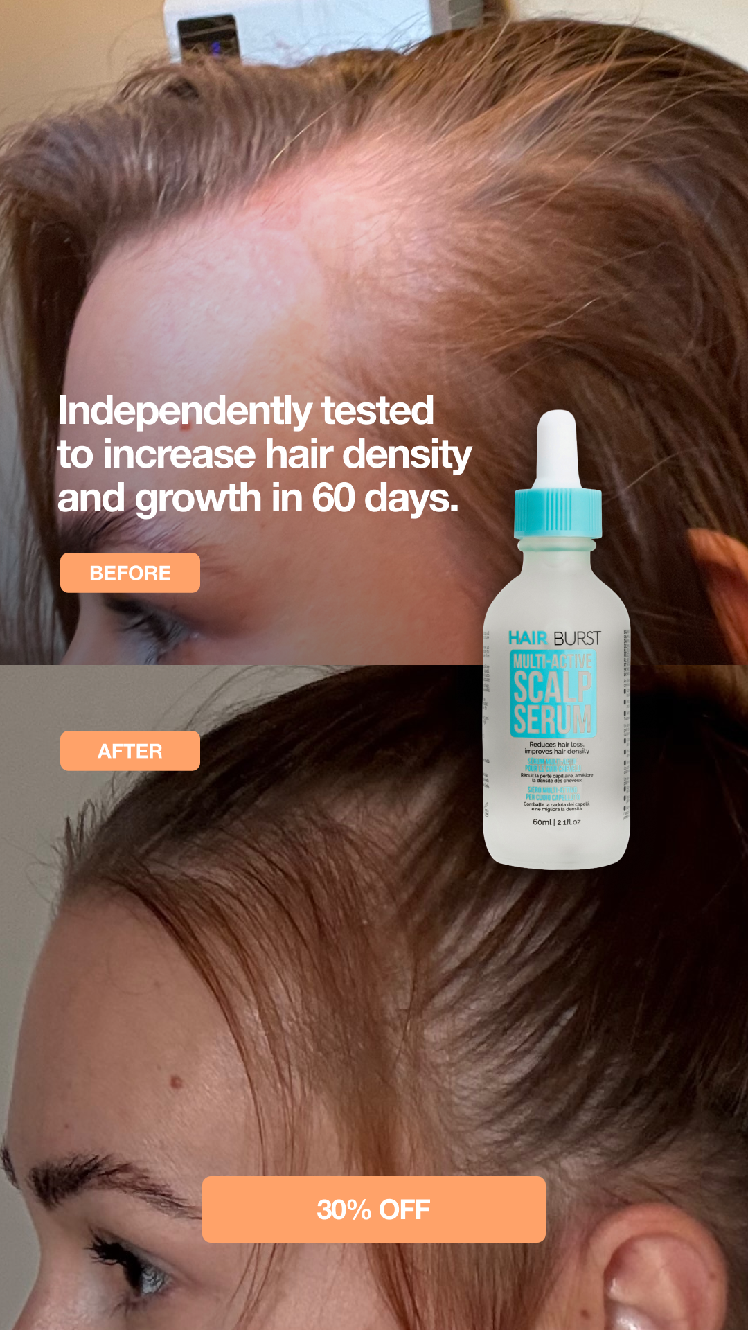 Hairburst Facebook ad