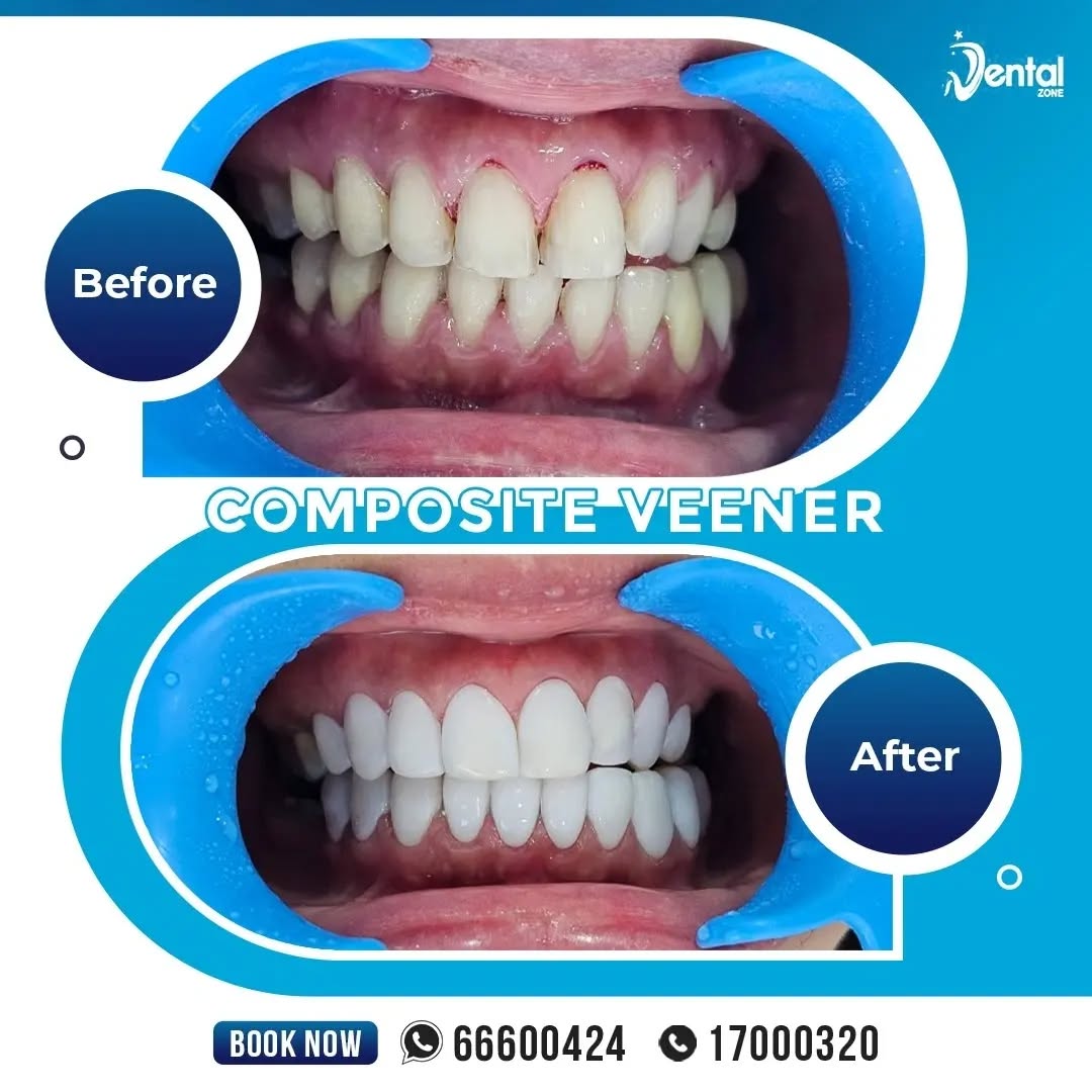 Dental Zone Facebook ad