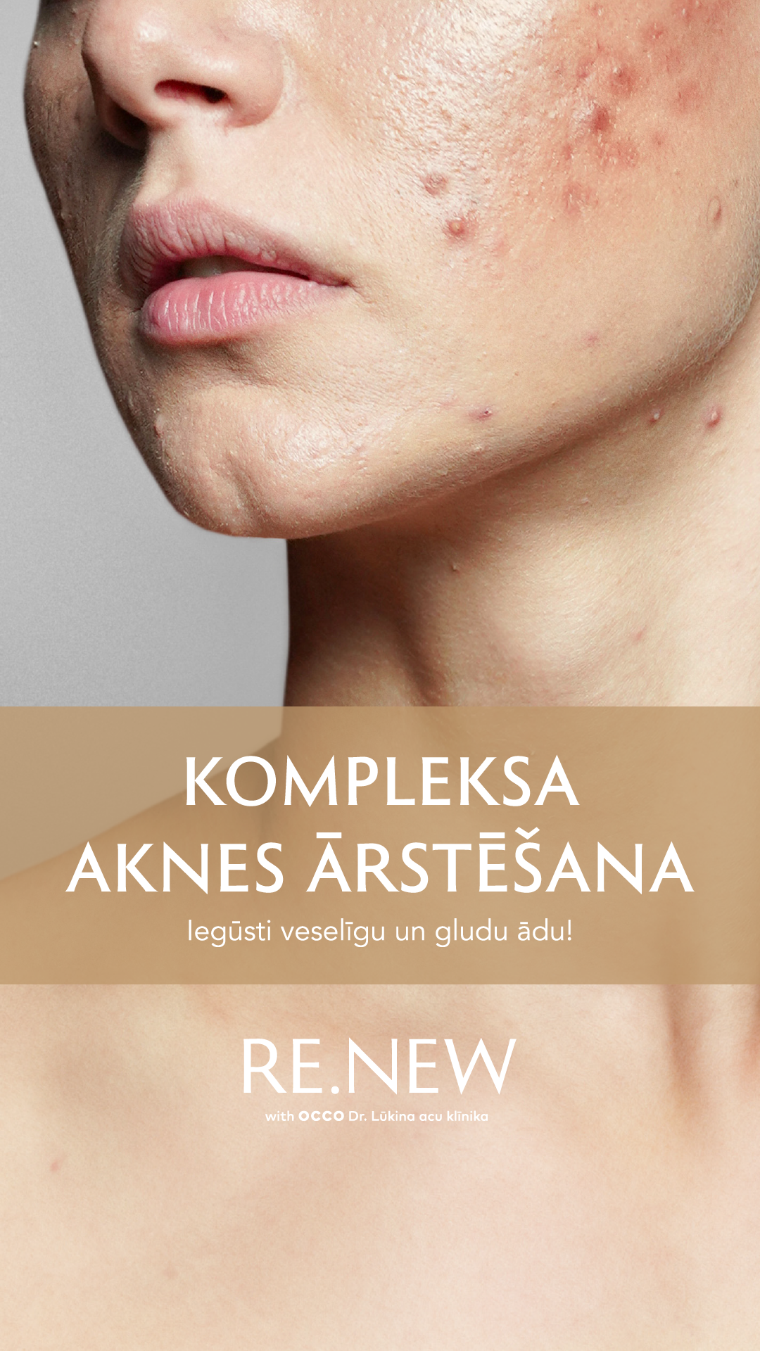 RE.NEW estētiskās medicīnas klīnika Facebook ad: Iegūsti Mirdzošu Ādu