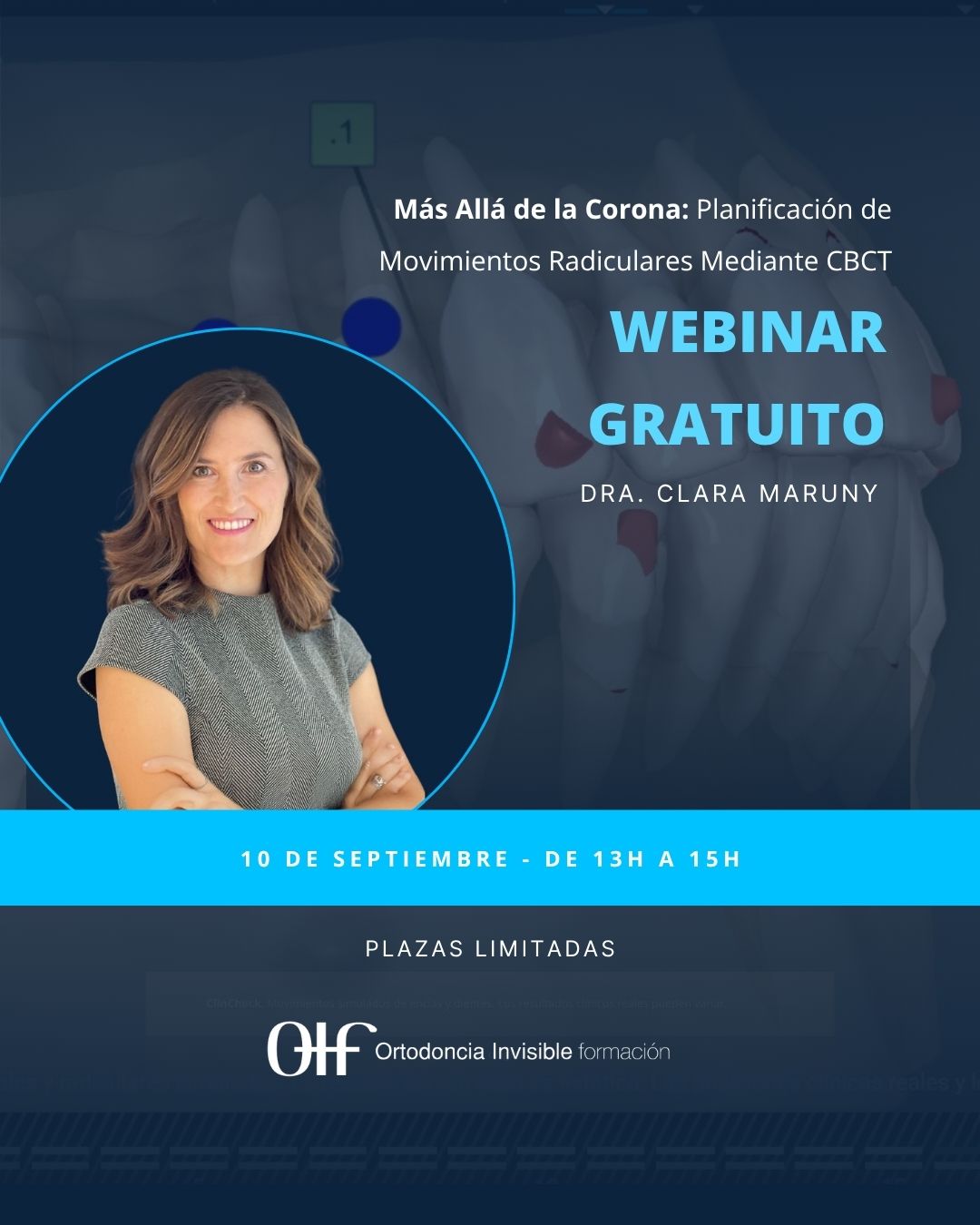 OIF Ortodoncia Invisible formacion Facebook ad: Webinar gratis: domina el CBCT