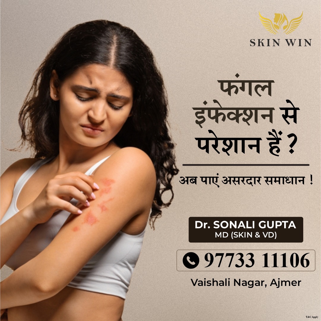 Skin Win - Skin, Laser & Hair Transplant Clinic Facebook ad
