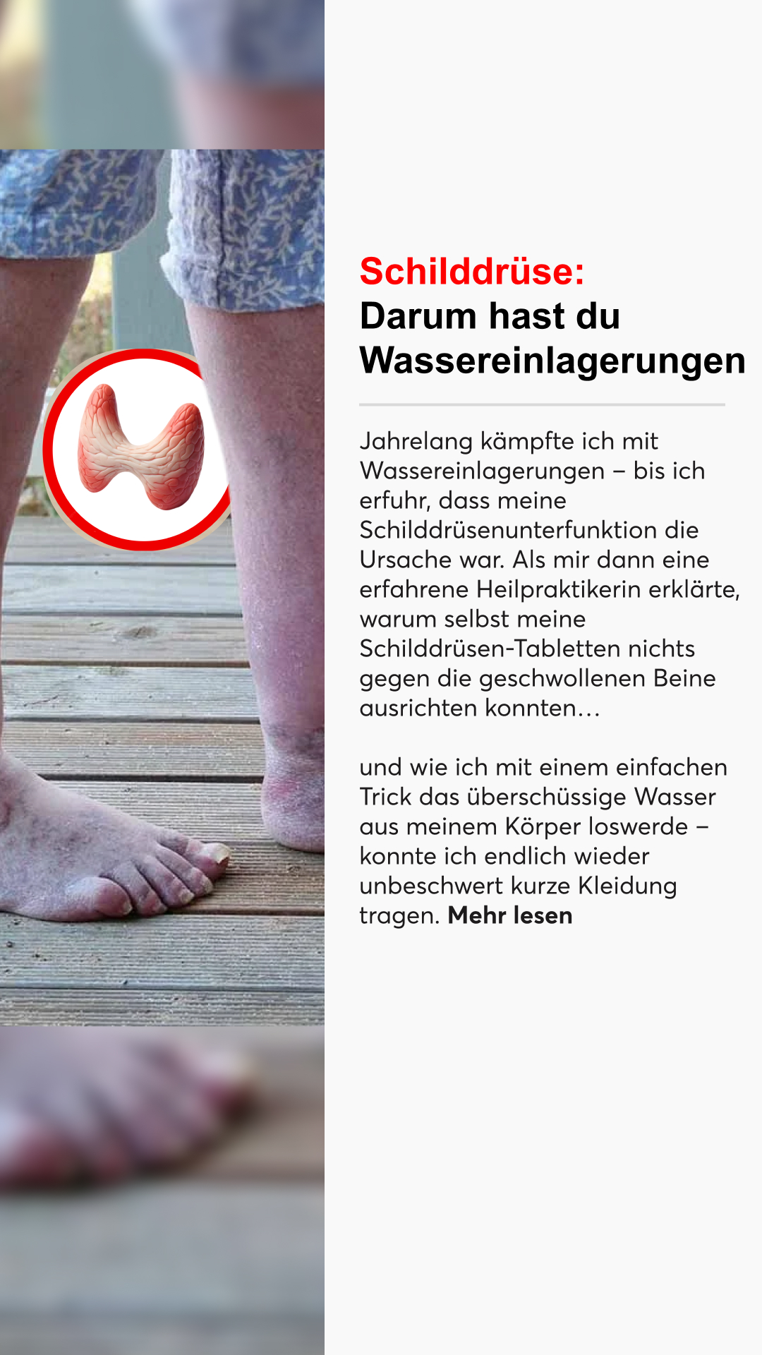 Mission Schilddrüse Facebook ad