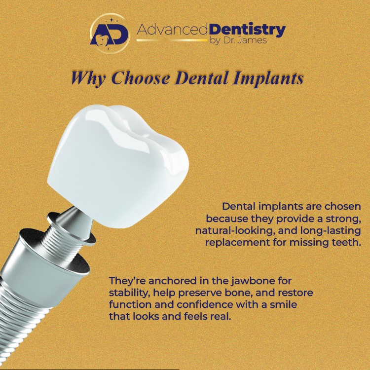 Advanced Dentistry by Dr. James Facebook ad: 𝐃𝐨𝐧’𝐭 𝐋𝐞𝐭 𝐚 𝐌𝐢𝐬𝐬𝐢𝐧𝐠 𝐓𝐨𝐨𝐭𝐡 𝐇𝐨𝐥𝐝…