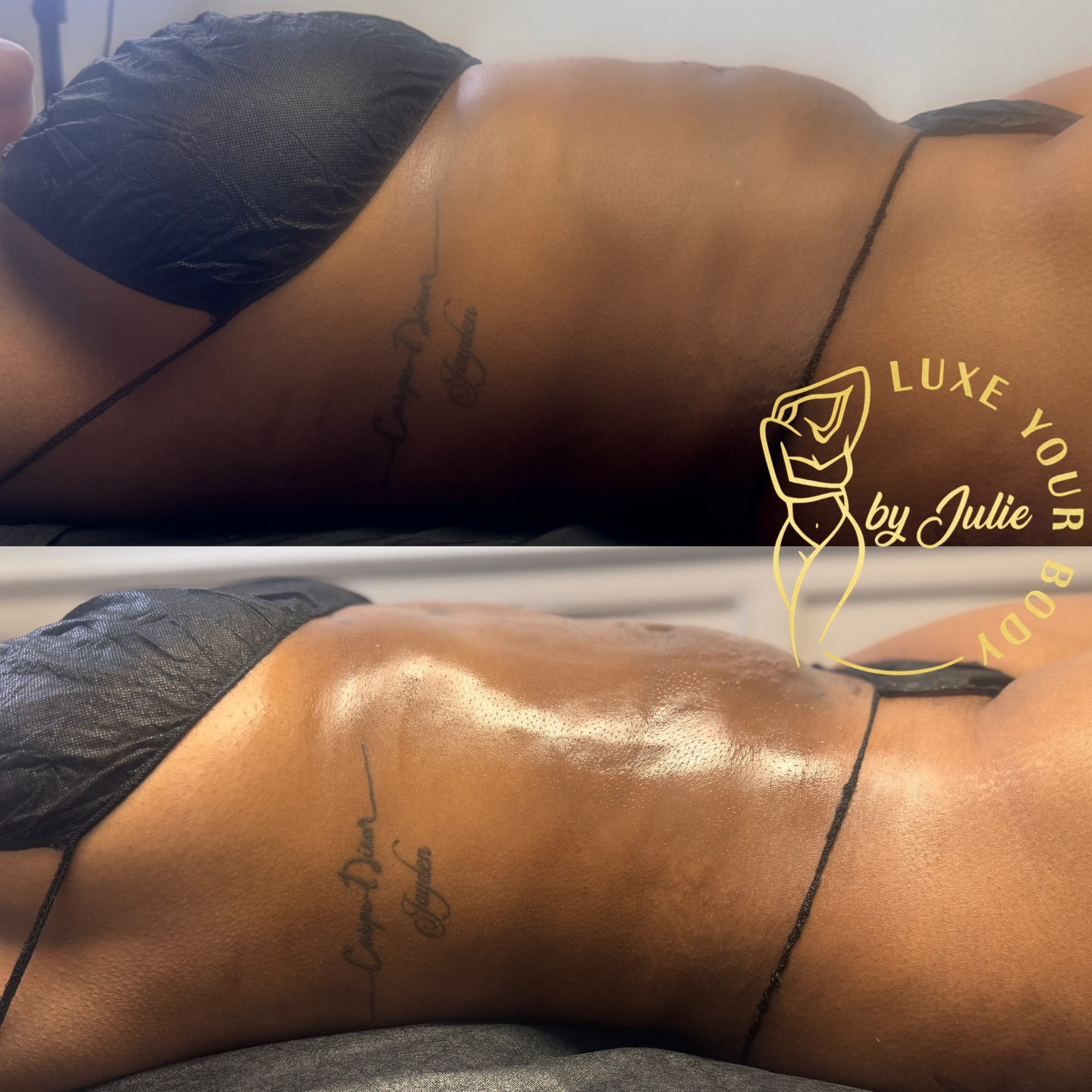 Luxe Your Body By Julie Facebook ad: Julie | Body Sculpting & Post-Op