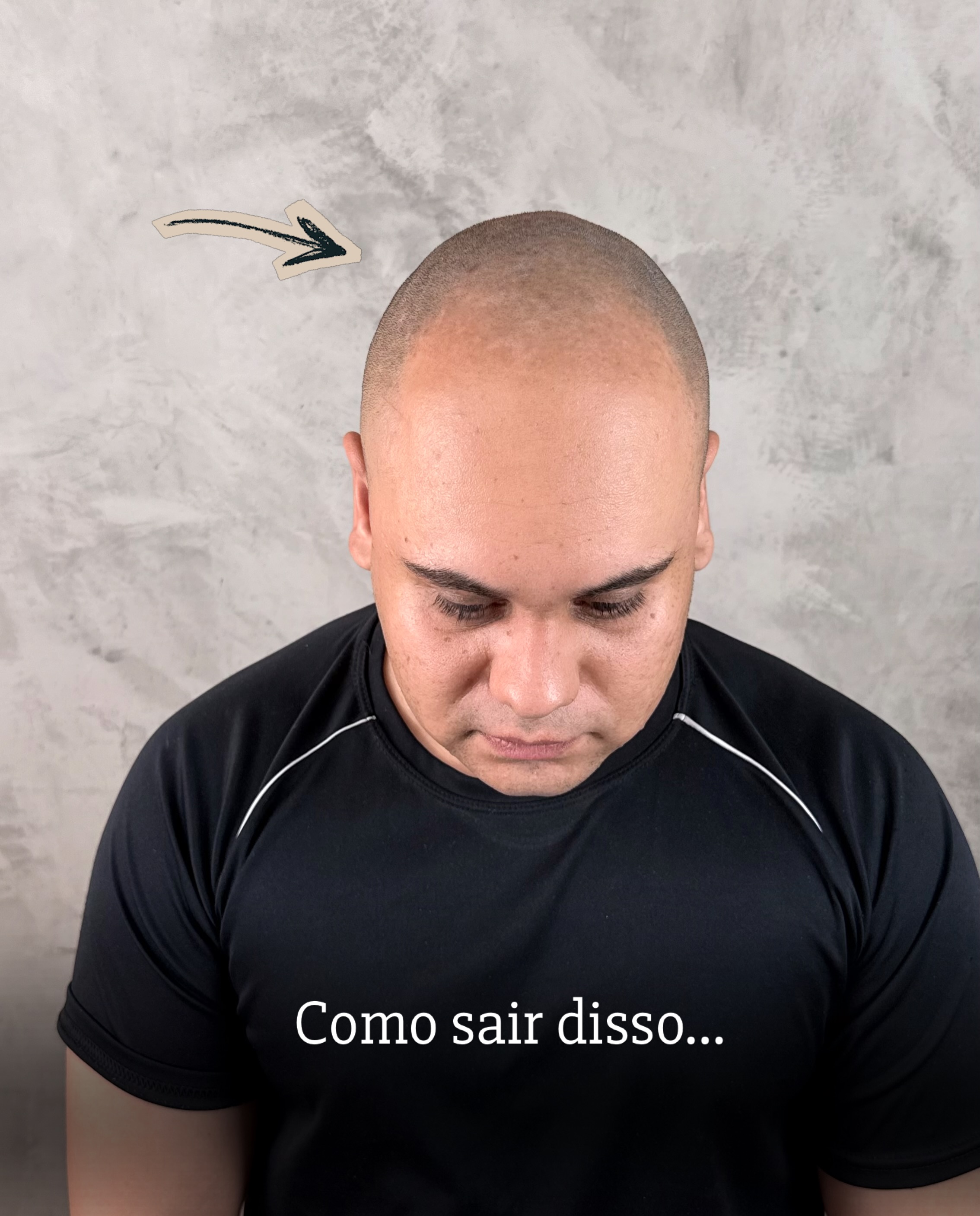 Geisa Silva - Micropigmentação Capilar Facebook ad: Nano Capilar 4D, Ultra-Realista