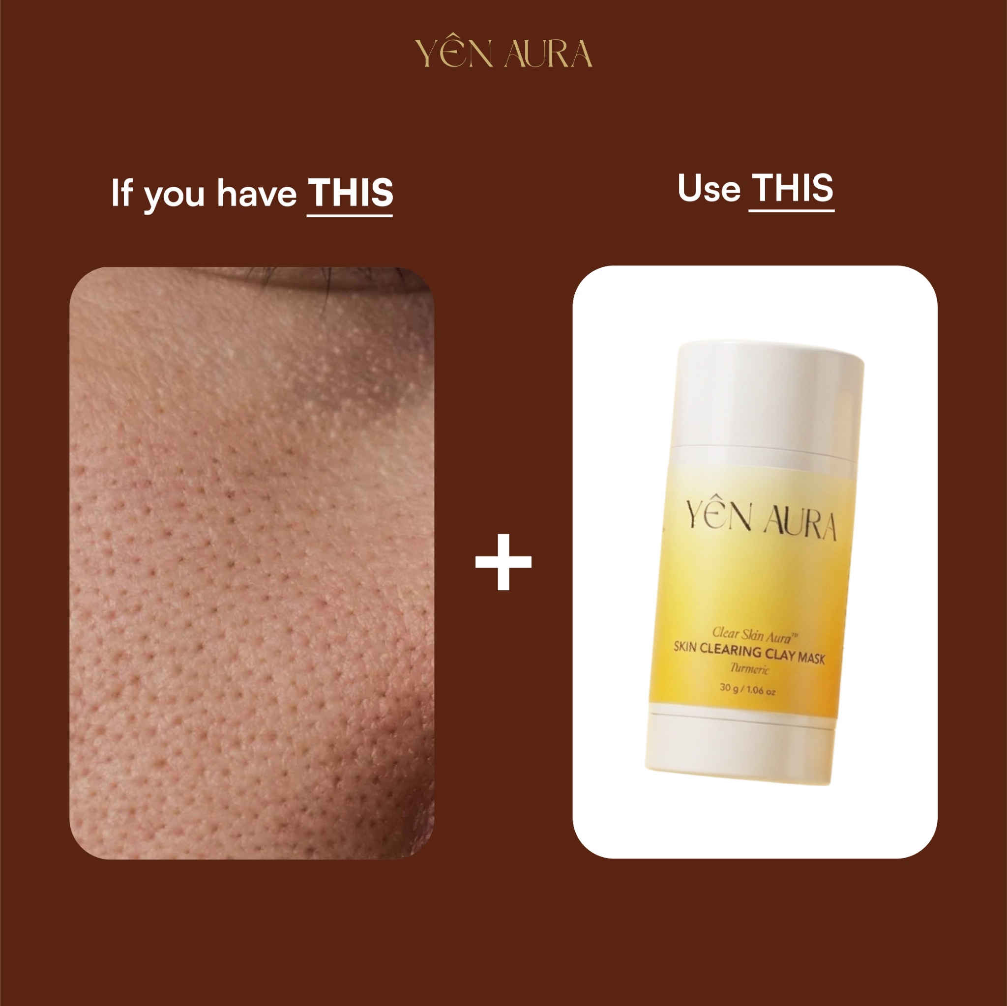 Yen Aura Facebook ad
