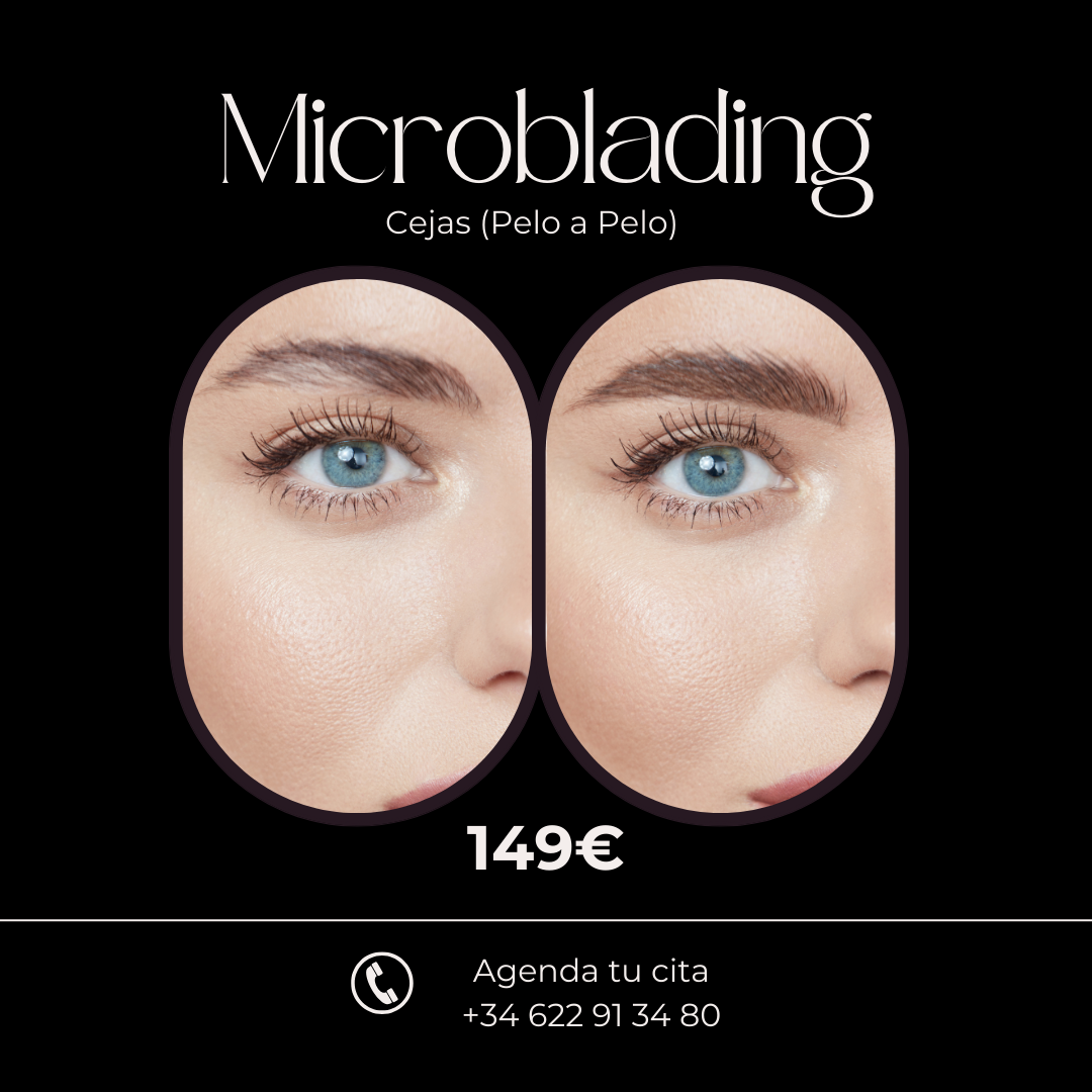 Centro Estética Avanzada VB en Alicante Facebook ad