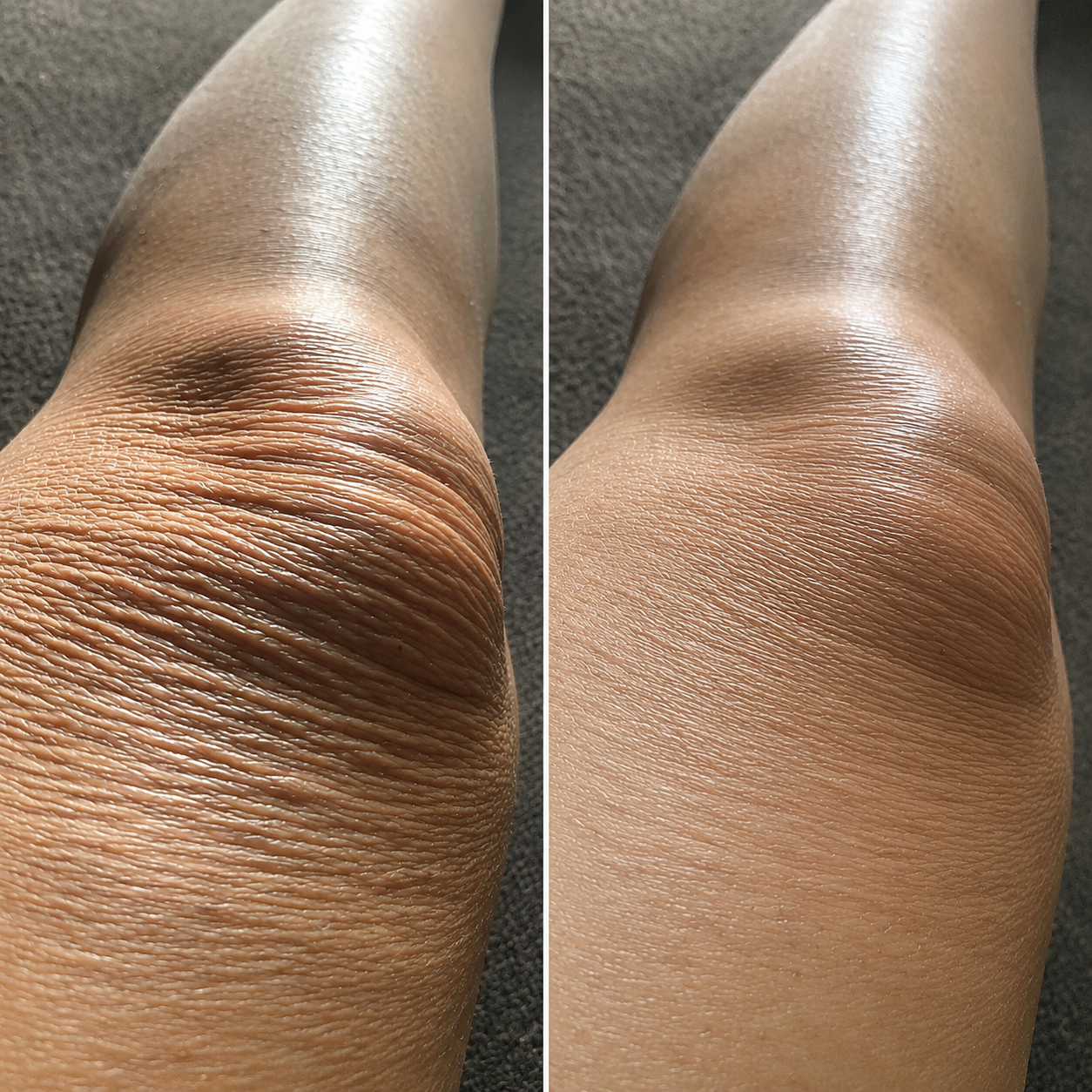 Michelle J Wellness Path Facebook ad: Read this if nothing has worked for your crepey skin