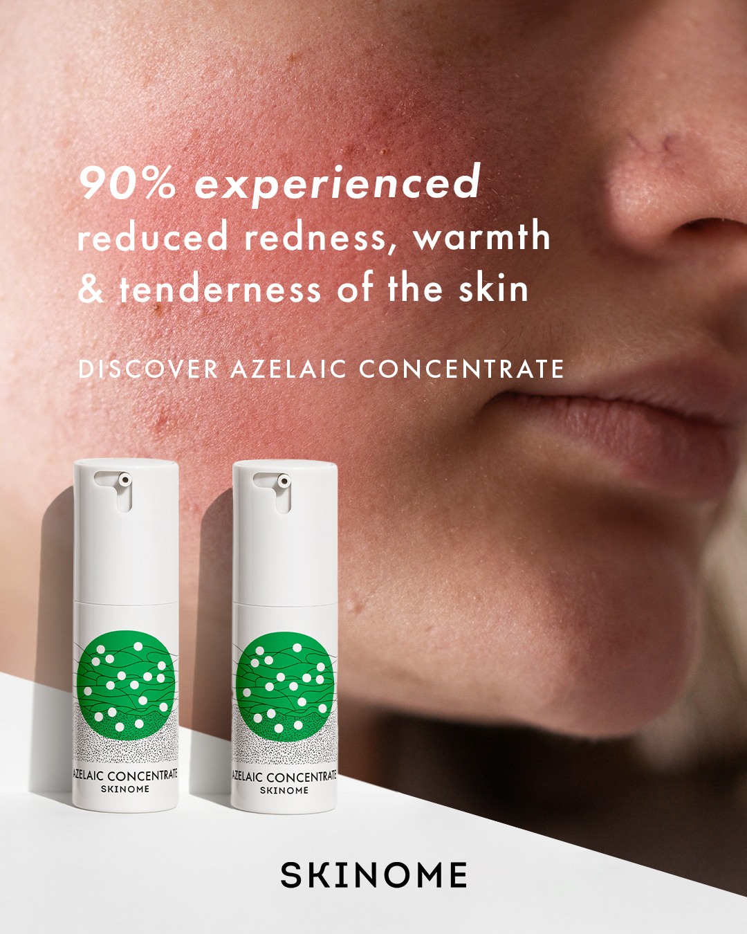 Skinome Facebook ad