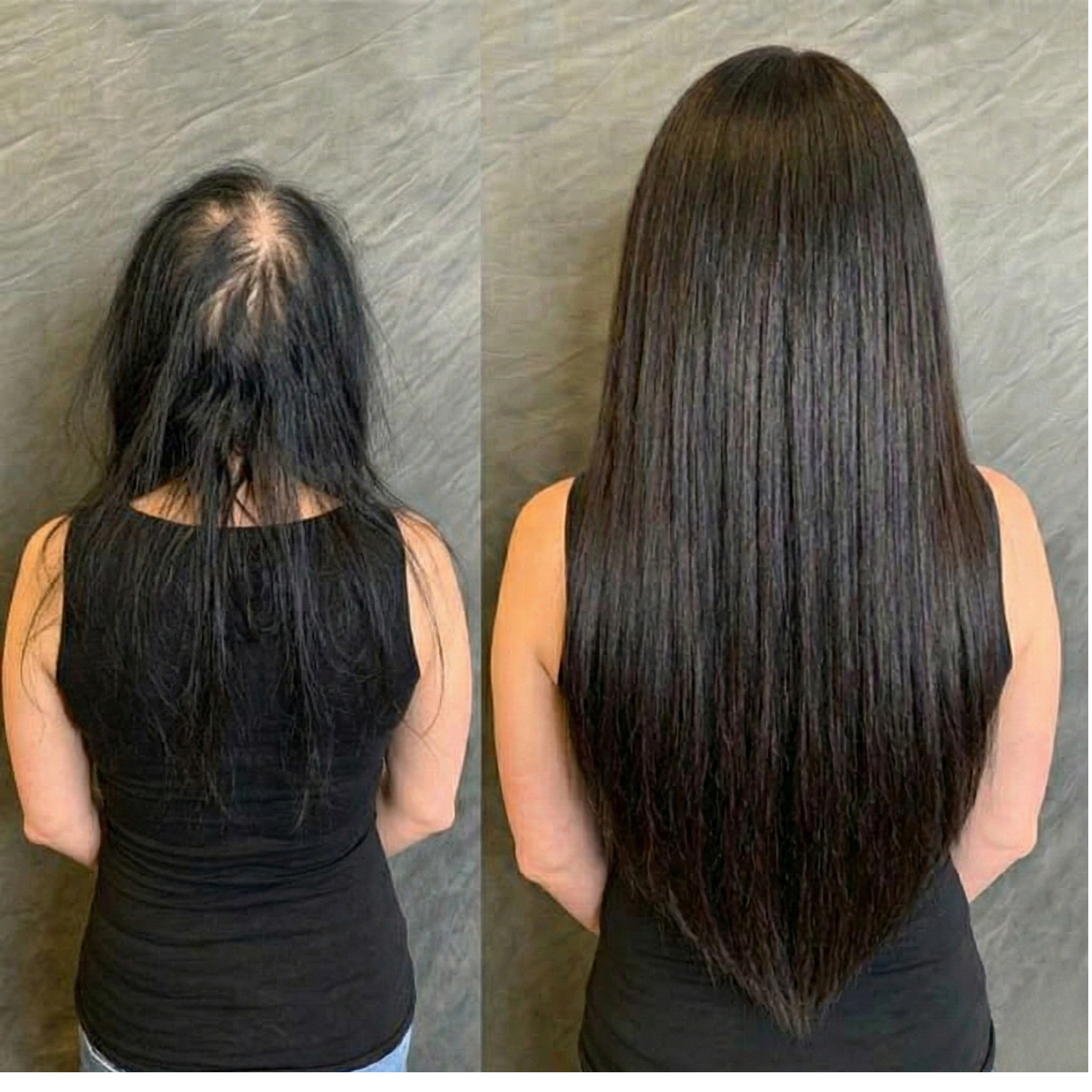 Jennifer Nelson Facebook ad: Reverse GLP-1 Hair Loss
