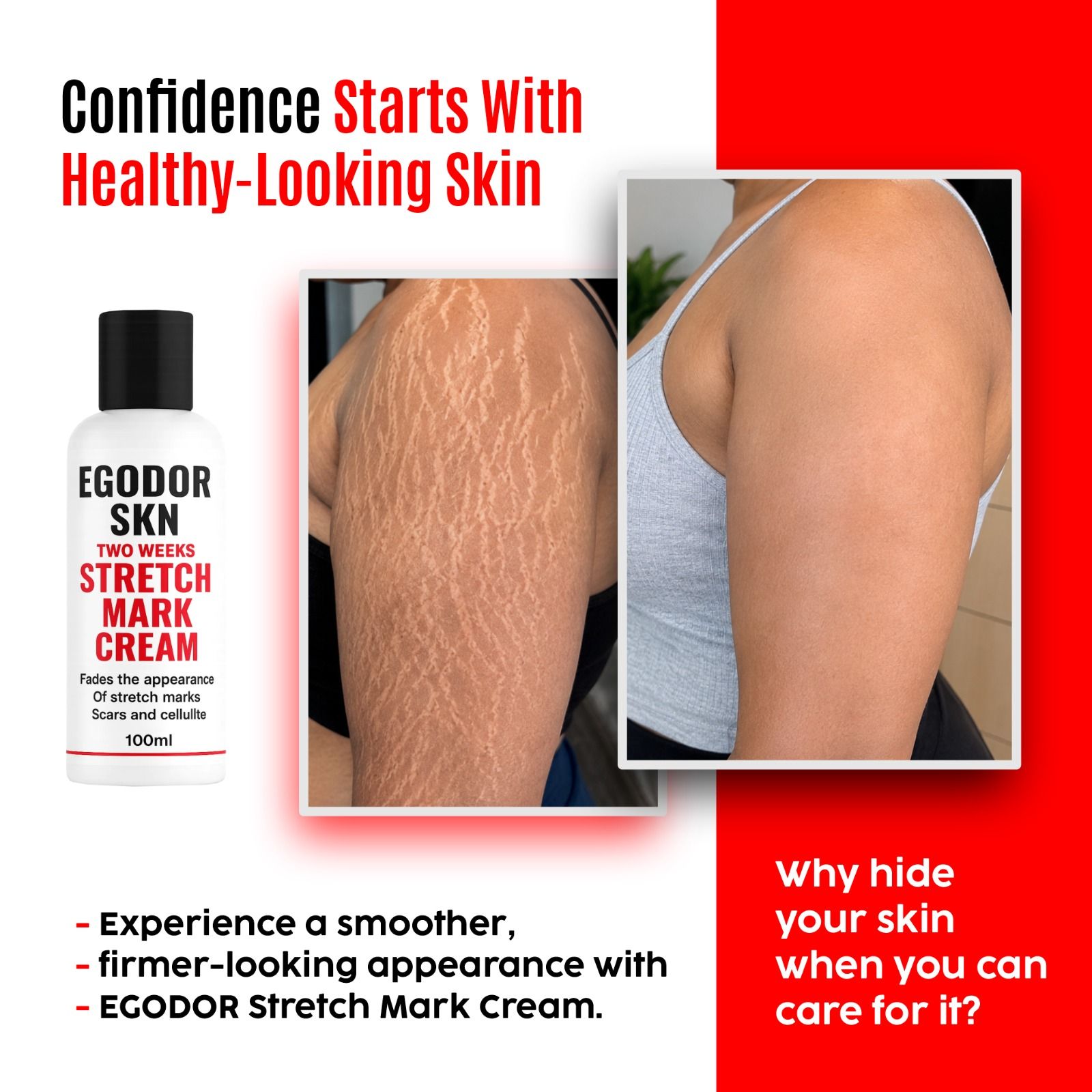 Egoodor skin Facebook ad: 2 WEEKS STRETCH MARK CREAM