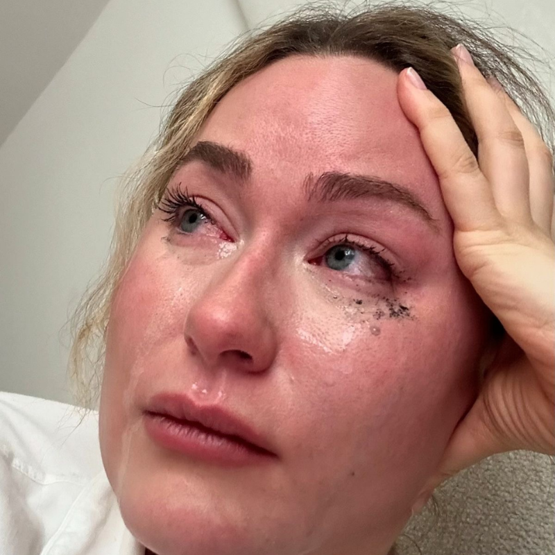 Katharina Deutz Facebook ad: Der Wahre Grund für Long Covid