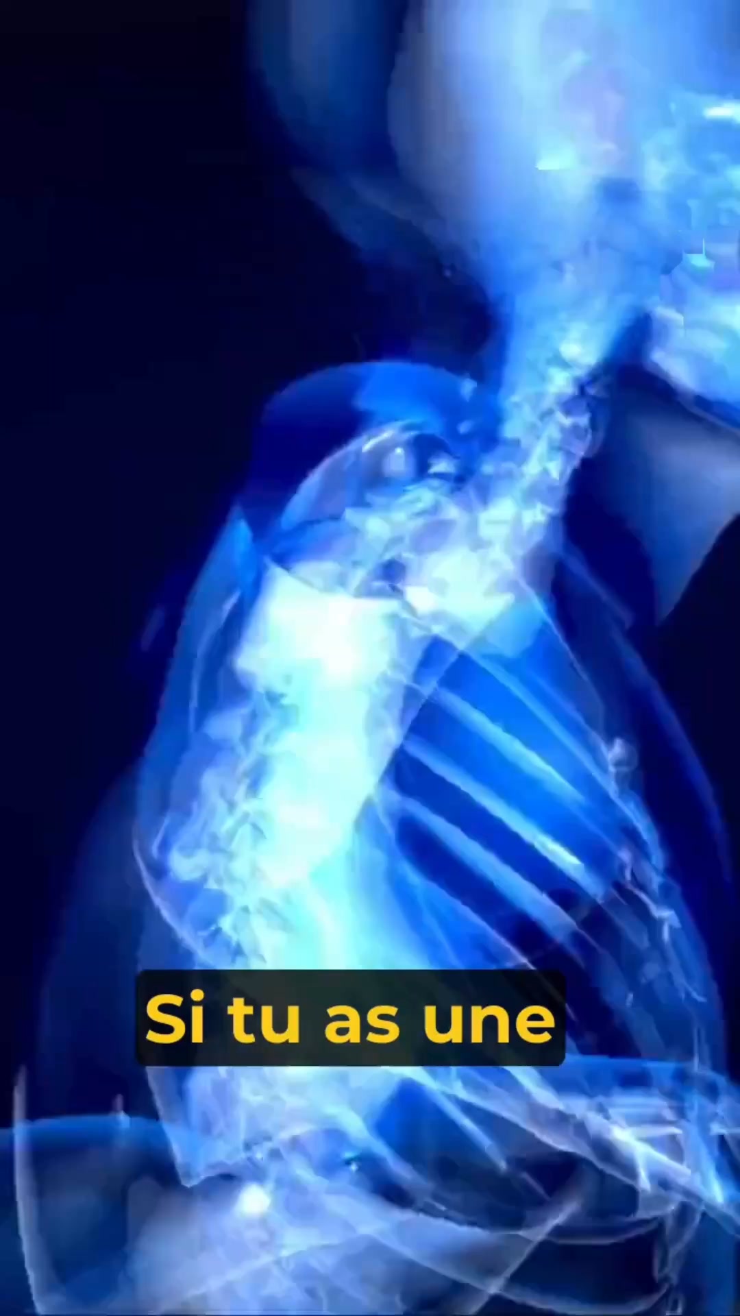 Serena Facebook ad: La vérité que les orthopédistes vous cachent!