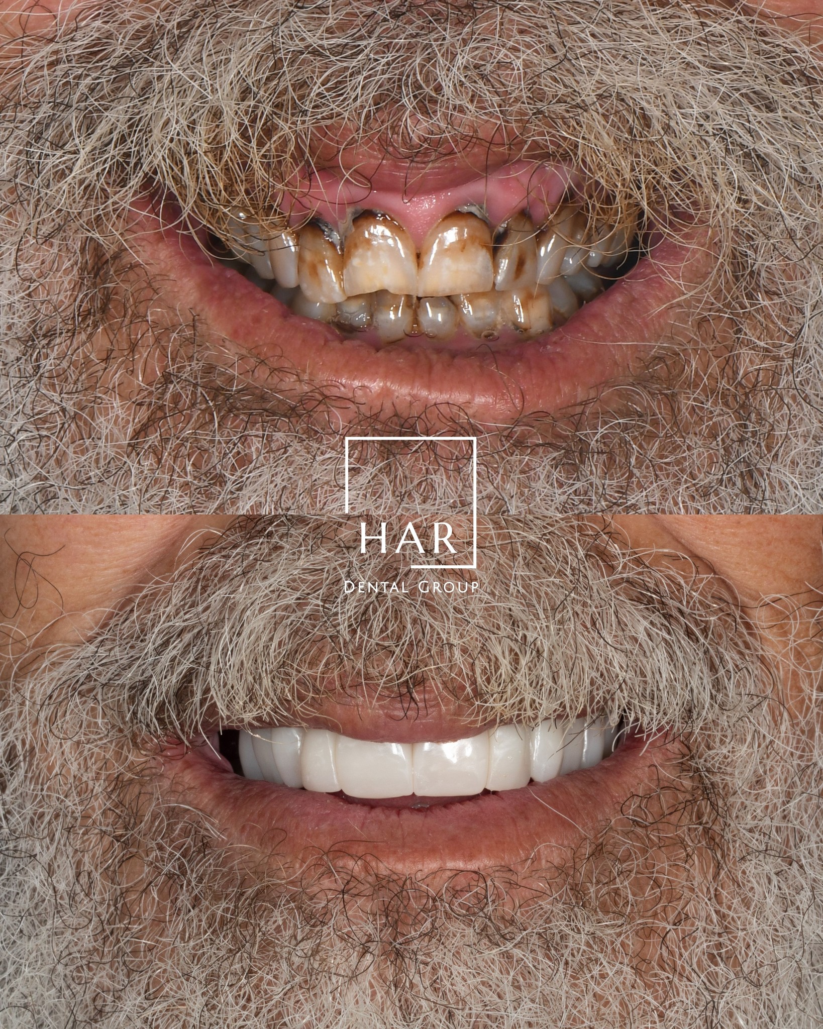 Amarillo Dental & Implant Center Facebook ad