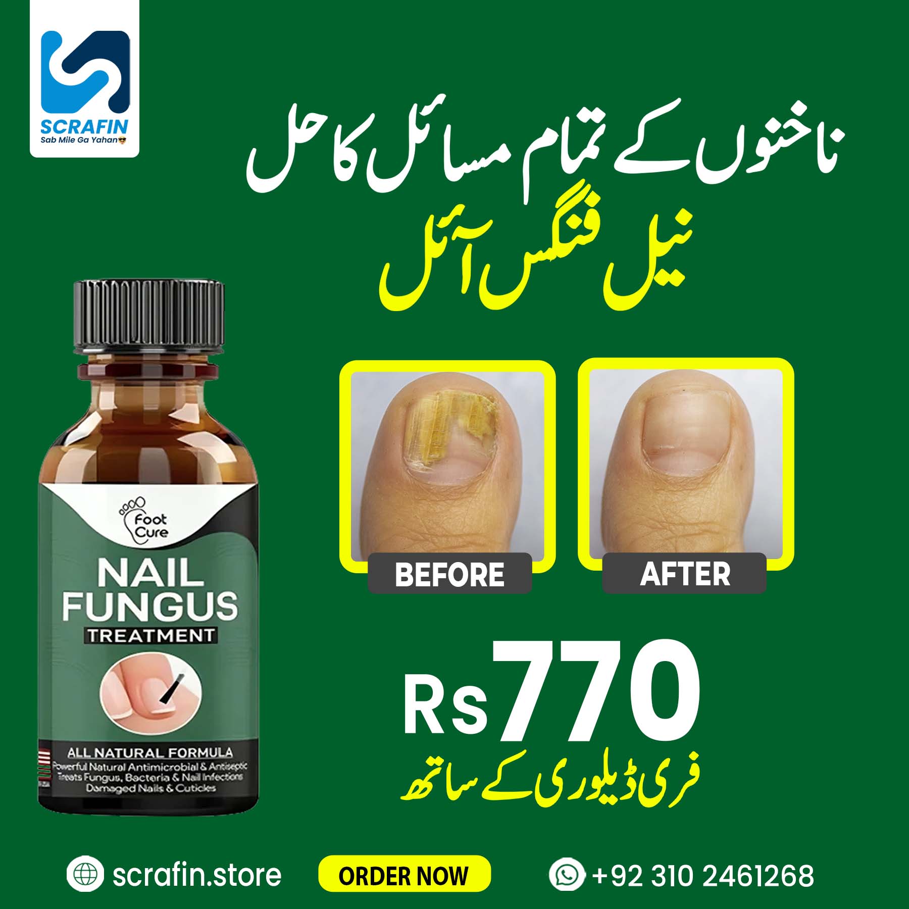 Scrafin Facebook ad