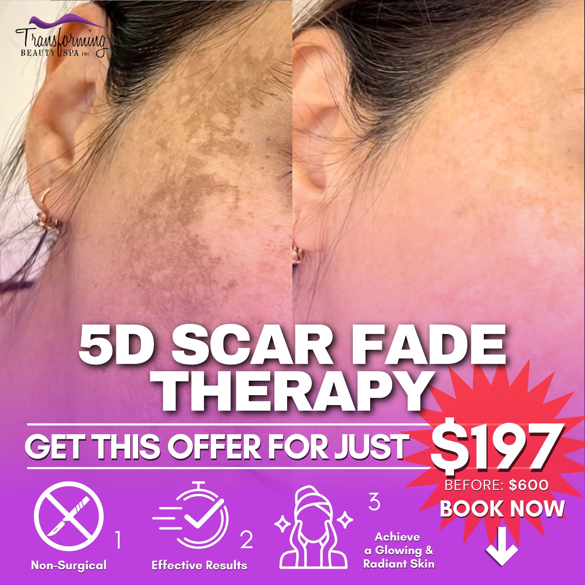 Transforming Beauty Facebook ad: 5D Scar Fade Therapy For $197 Only