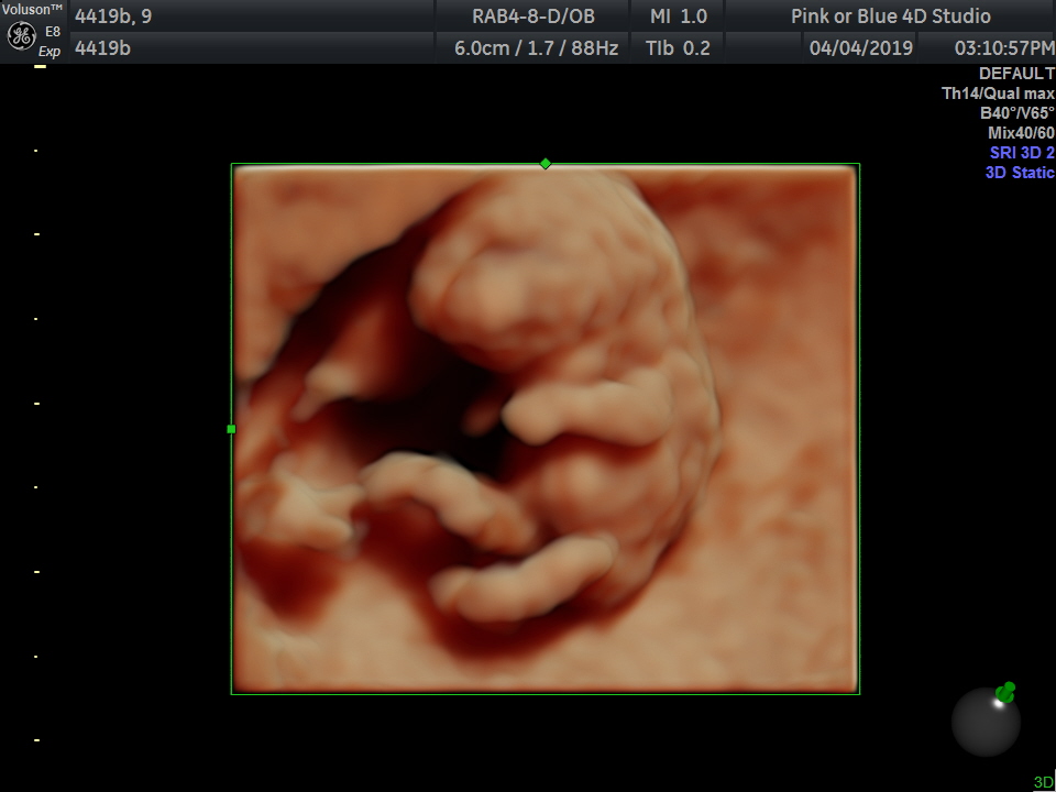 Pink or Blue 4D Ultrasound Studio Facebook ad: Pink or Blue 4D Ultrasound | Scheduling and Booking Website