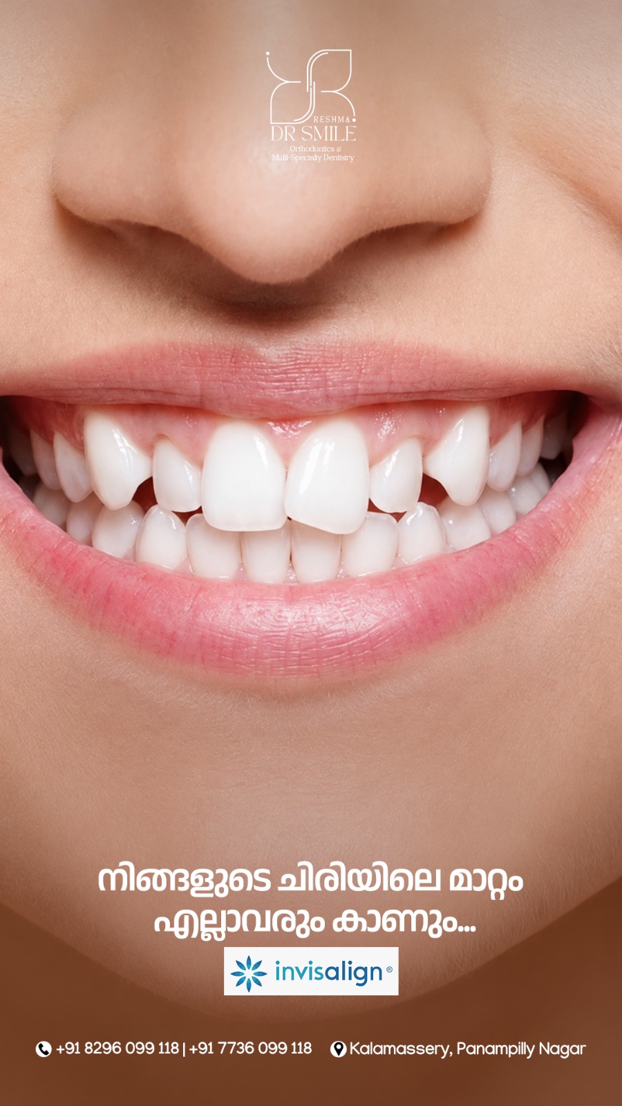 Dr Smile Orthodontics Facebook ad: Straighten your teeth without metal braces!