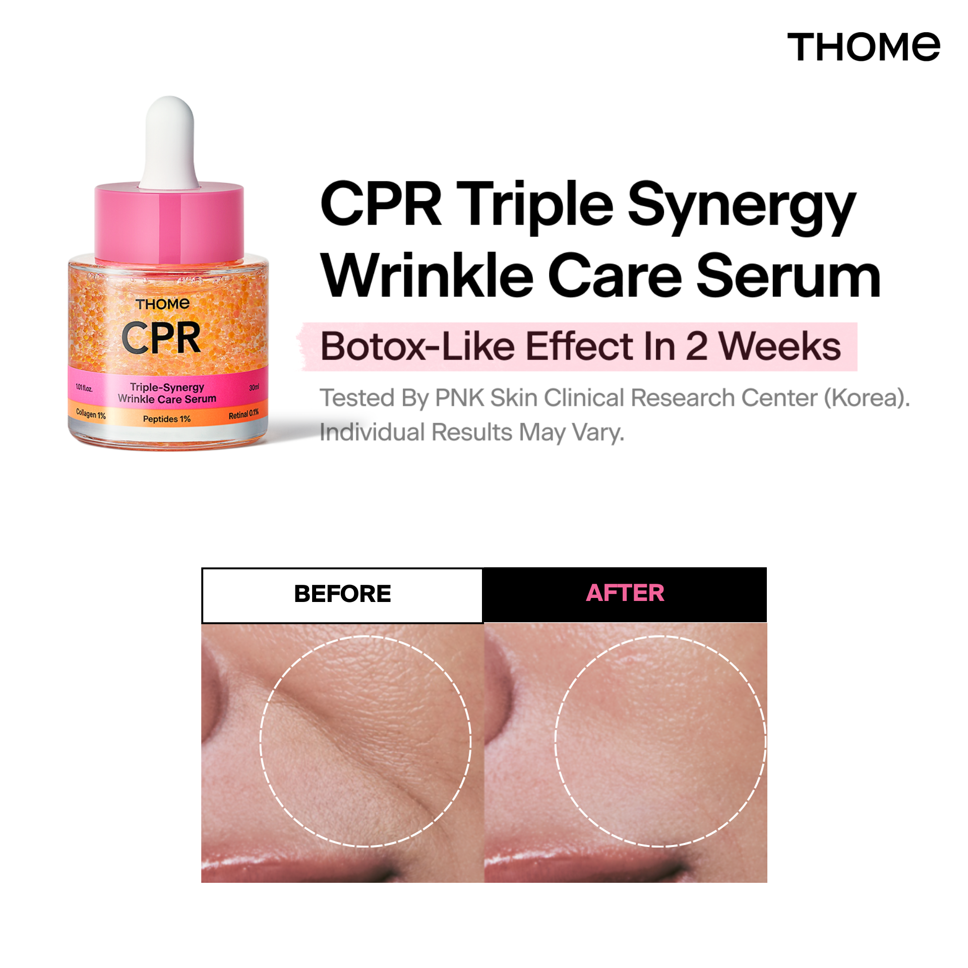 THOME Global Facebook ad: THOME CPR Serum - Collagen 1% + Peptide 1% + Retinal 0.1%…