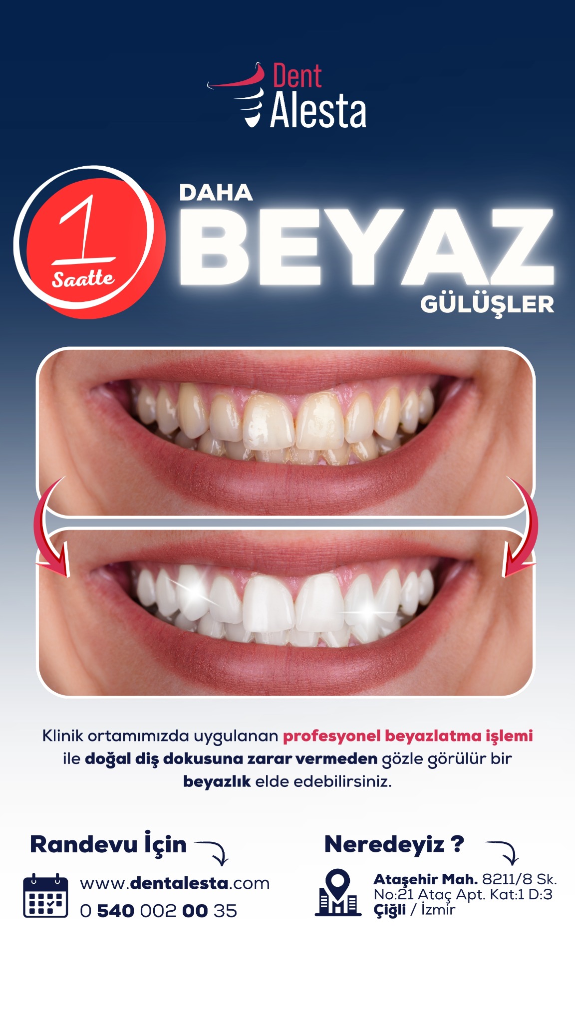 Dent Alesta Diş Kliniği Ataşehir Facebook ad from Feb 17, 2026