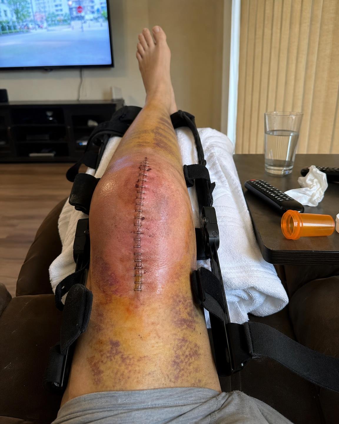 Linda Baker Facebook ad: 12 years of bone-on-bone knee pain gone in 2 days?