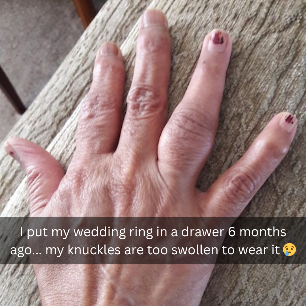 The Menopause Journal Facebook ad: Menopause did this to her hands