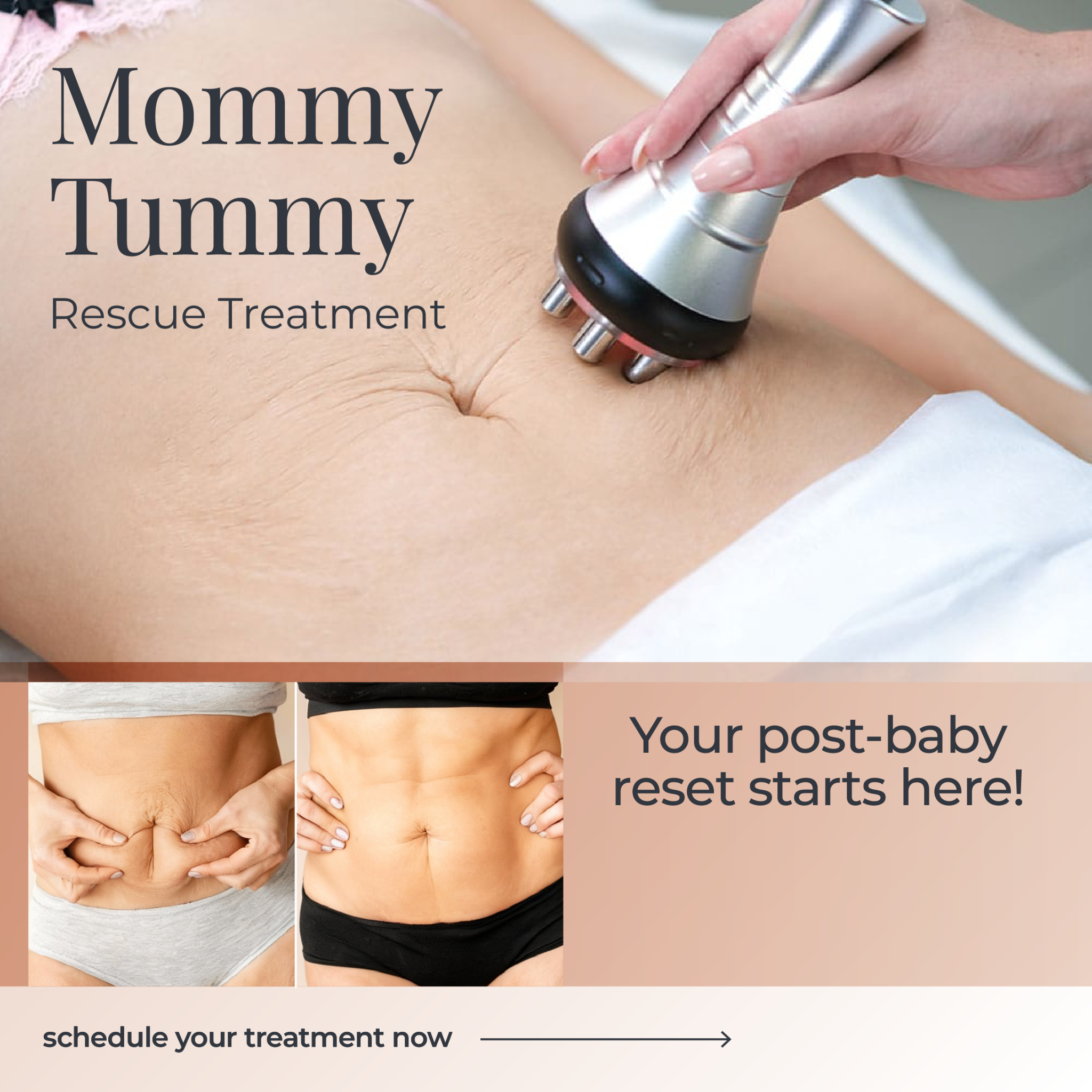 I Love Skin Treatments Facebook ad