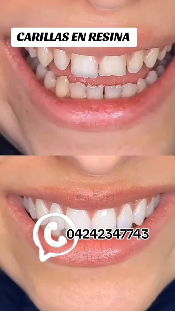 clínica dental caracas Facebook ad: ¡Atención Caracas!