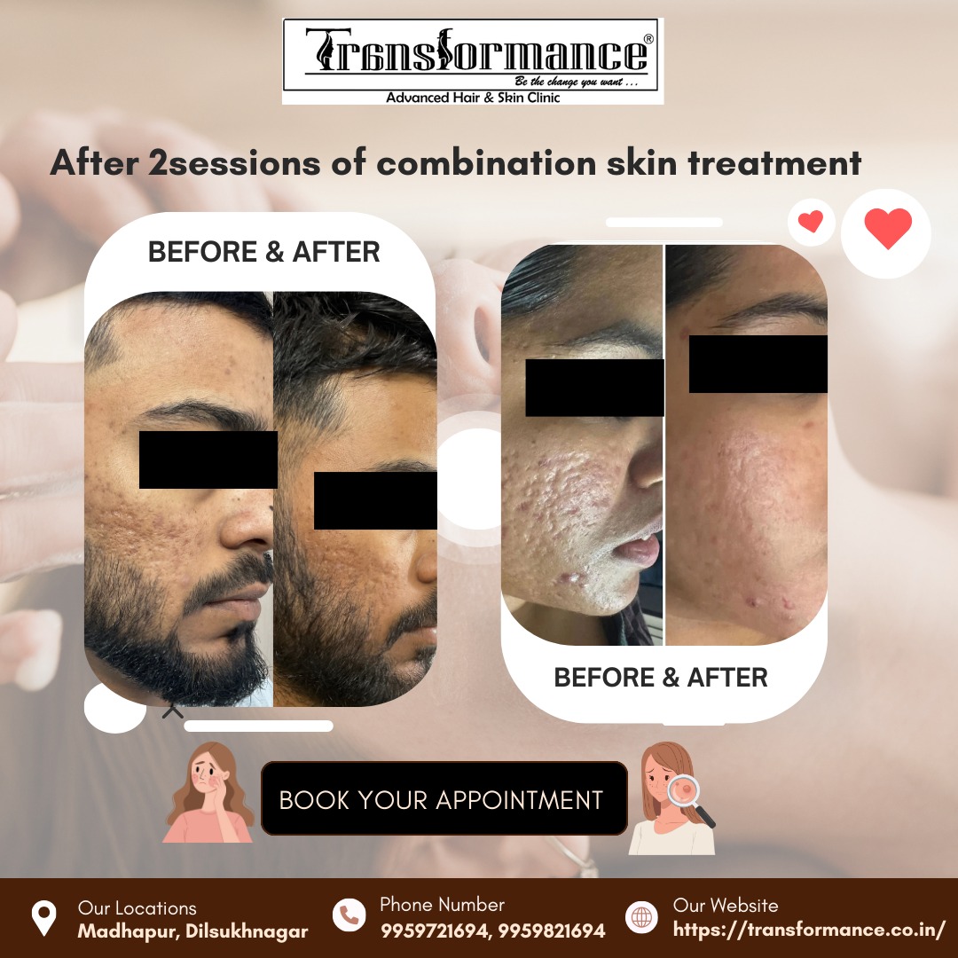 Transformance Facebook ad: Visible Results in Just 2 Sessions!