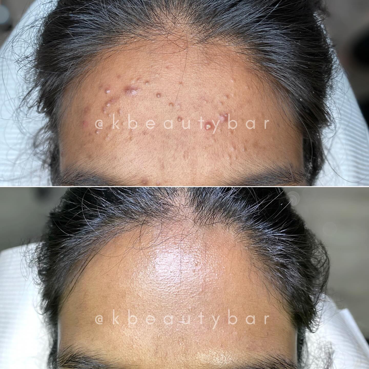 Kbeautybar Facebook ad: Results are speaking!