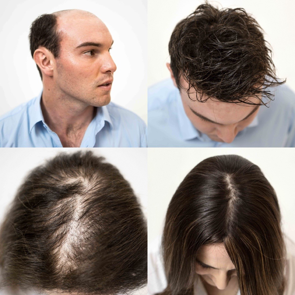 Uncommon Hair and Skin Facebook ad: Losing hair? You have more options than you think.